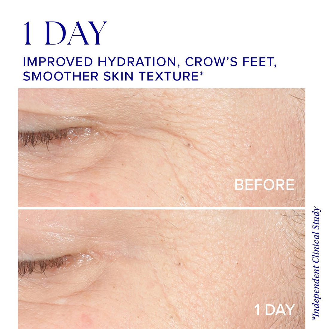 iS CLINICAL Youth Intensive Crème, 1.7 Oz