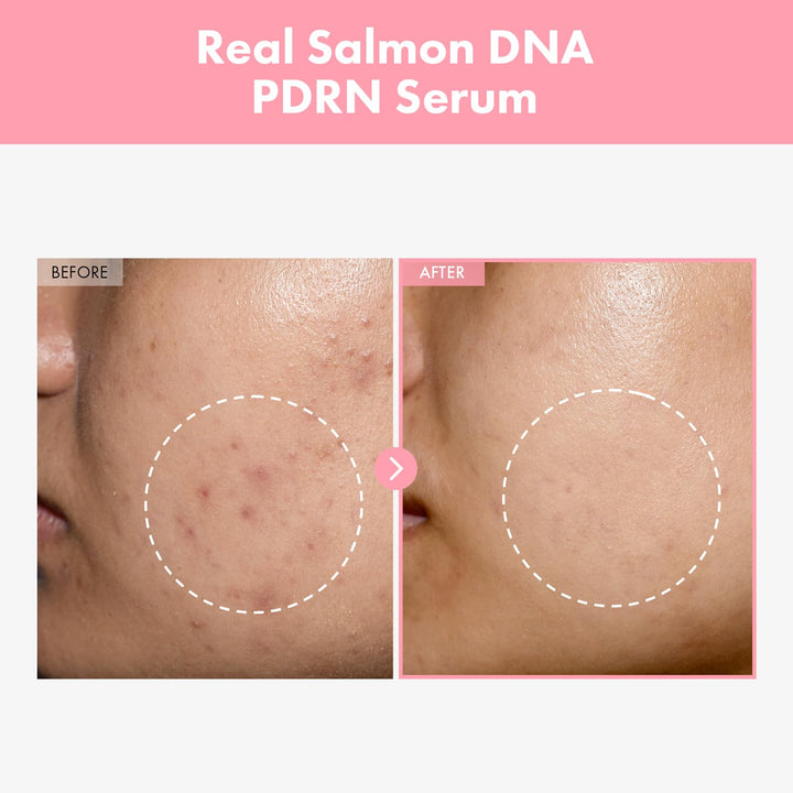 TOSOWOONG Pink Peptide 12 PDRN Serum With Salmon DNA PDRN 10,320ppm, 12 Peptides, Niacinamide, Skin glow, Hydrating, Moisturizing, Firming, Uneven Skin Tone, Korean Skincare, 33ml, 1.11 fl.oz.