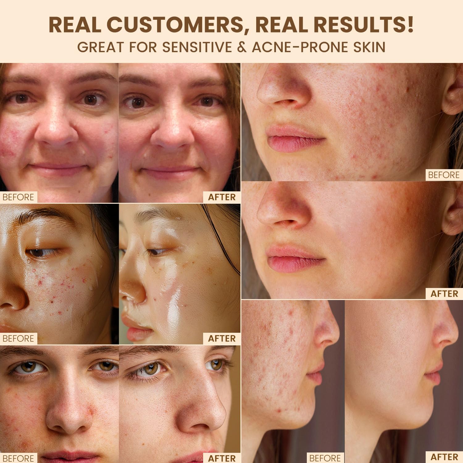 Jardient Beef Tallow Honey Balm for Skin: 100% Grass-Fed Beef Tallow Moisturizer For Face and Body - Organic Moisturizer Cream with Olive Oil Manuka Honey for Eczema and Dry Skin 2OZ