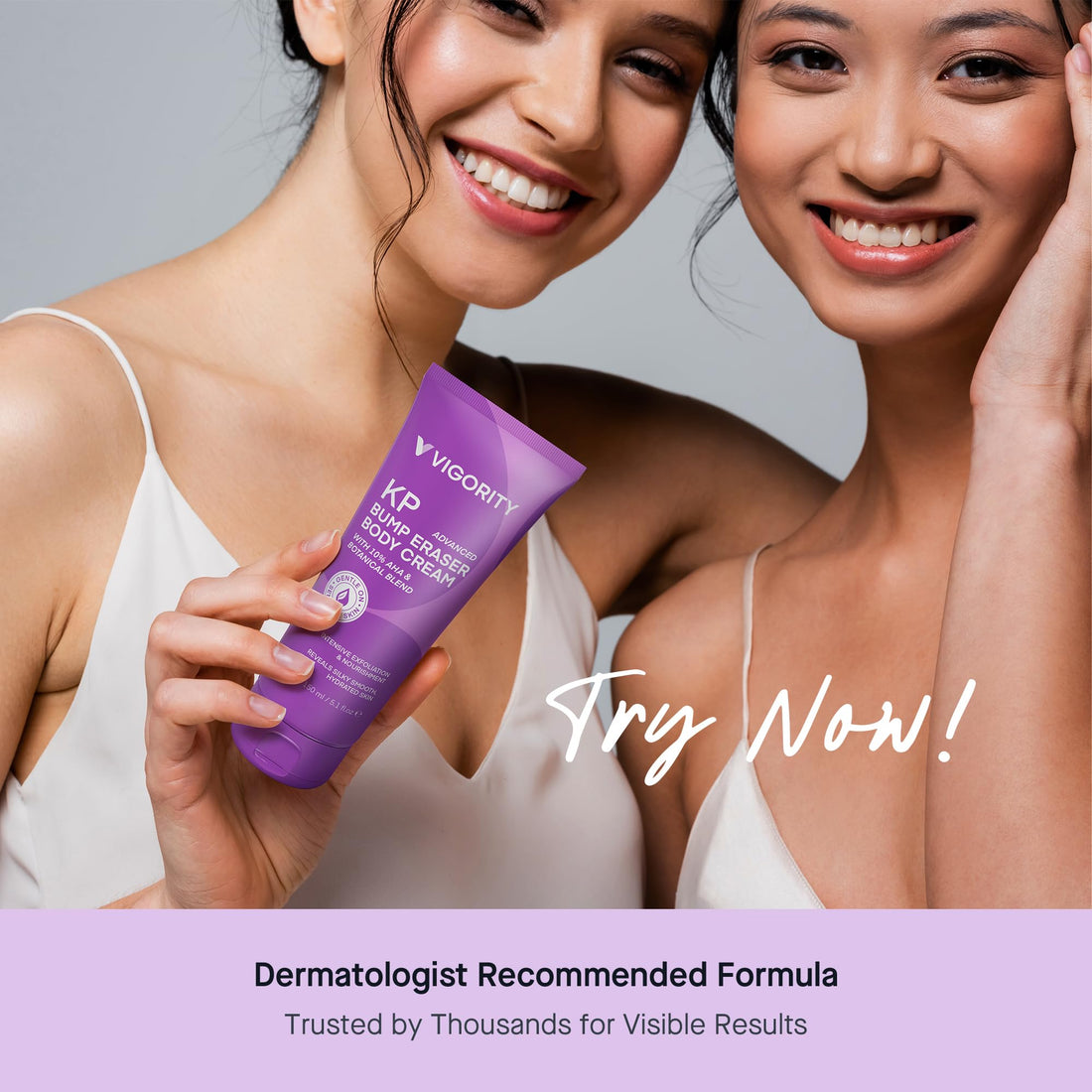 Vigority KP Bump Eraser for Keratosis Pilaris: Body Moisturizer Exfoliating Cream - KP Bump Be Gone Treatment for Bumpy Dry Rough Skin