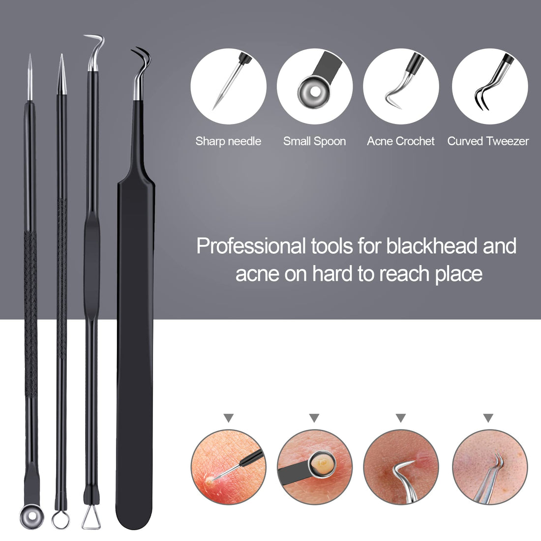 Pimple Popper Tool Kit 10 Pcs, MENOLY Newest Blackhead Remover Pimple Comedone Extractor Tools for Easy and Fast Removal of Blackheads, Pimples and Blemish on Face, with Elaborate Leather Bag