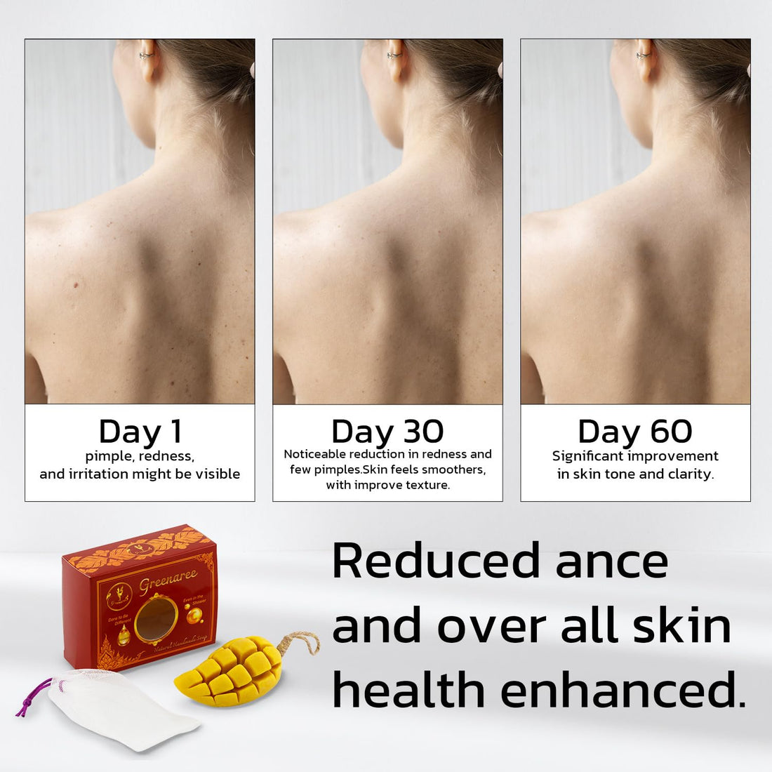 Greenaree Fruit-Shaped Natural Soap Bar – Moisturizing with Vitamin C & Collagen, Thai Botanicals, Gentle Cleanser for Sensitive Skin, Includes Foam Net, Ideal for Body & Hands, Gift-Ready (1 Pack)