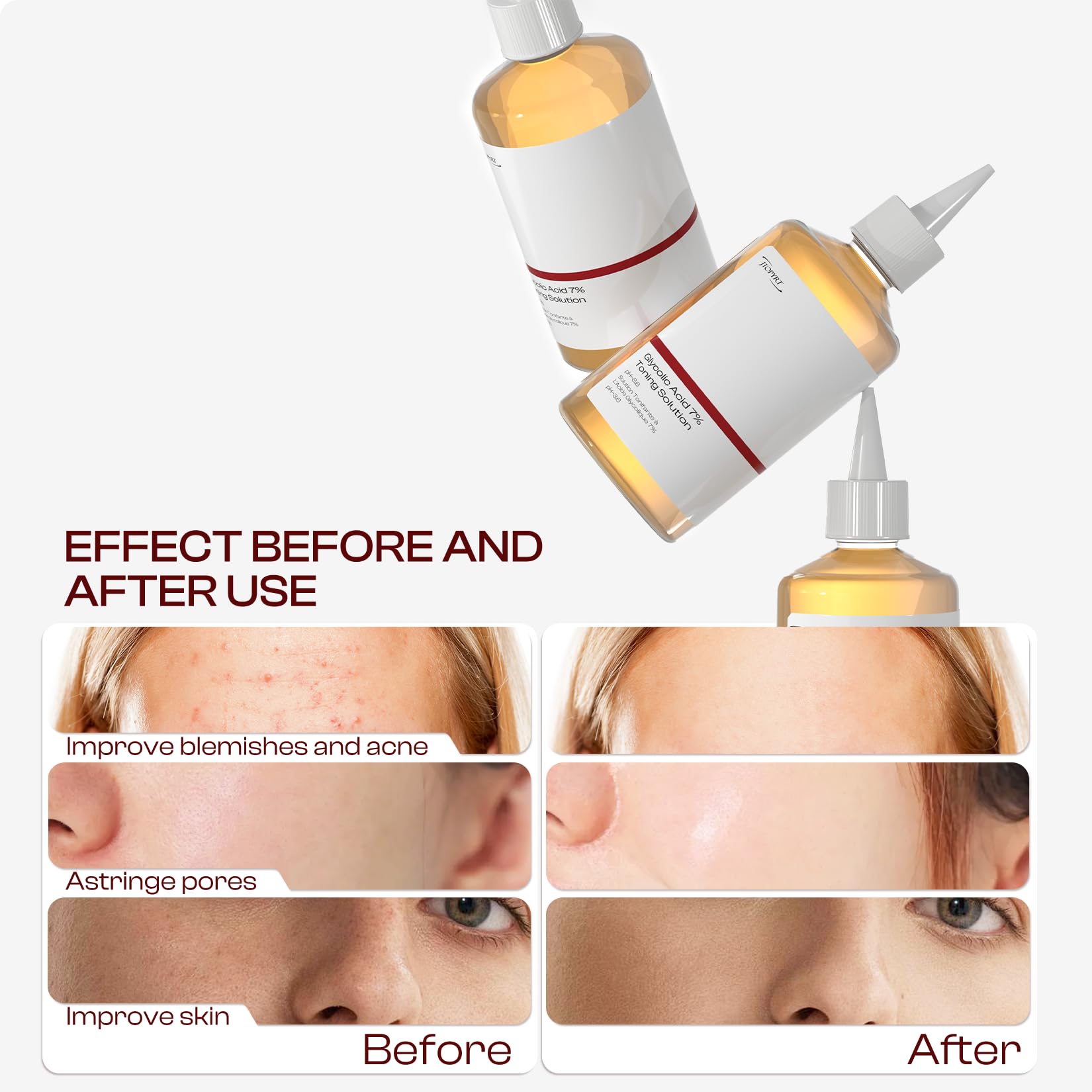 Glycolic Acid 7% Exfoliating Toner: Glycolic Acid Toner Gently Exfoliates 240ml - Glycolic Acid Toning Solution Reduces Skin Blemishes