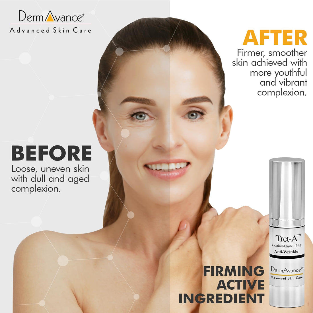 DermAvance Tret A Anti Aging Face Cream - Retinaldehyde 0.15% Lotion for Advanced Anti-Aging and Radiance - Face Lotion for Women Anti Aging - Facial Care 15ml