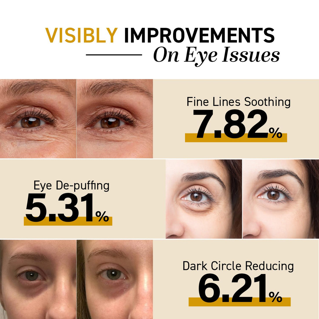 CITYGOO Eye Cream For Dark Circles: Eye Puffiness Under Eye Bags Treatment - Anti-Wrinkle (Snail Eye Stick 1 Count)