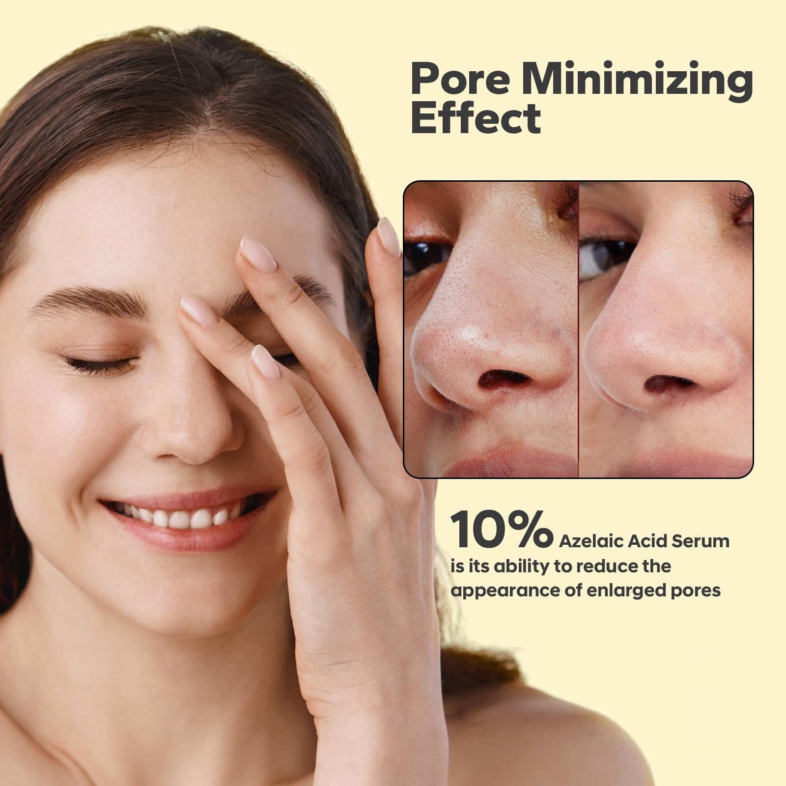 SilkySecret 10% Azelaic Acid Serum (1 Fl Oz), Niacinamide Infused Skin Care for Face, Pore Minimizing, Redness Relief, Reduce Cystic Acne Scar, Blemish Control Serum