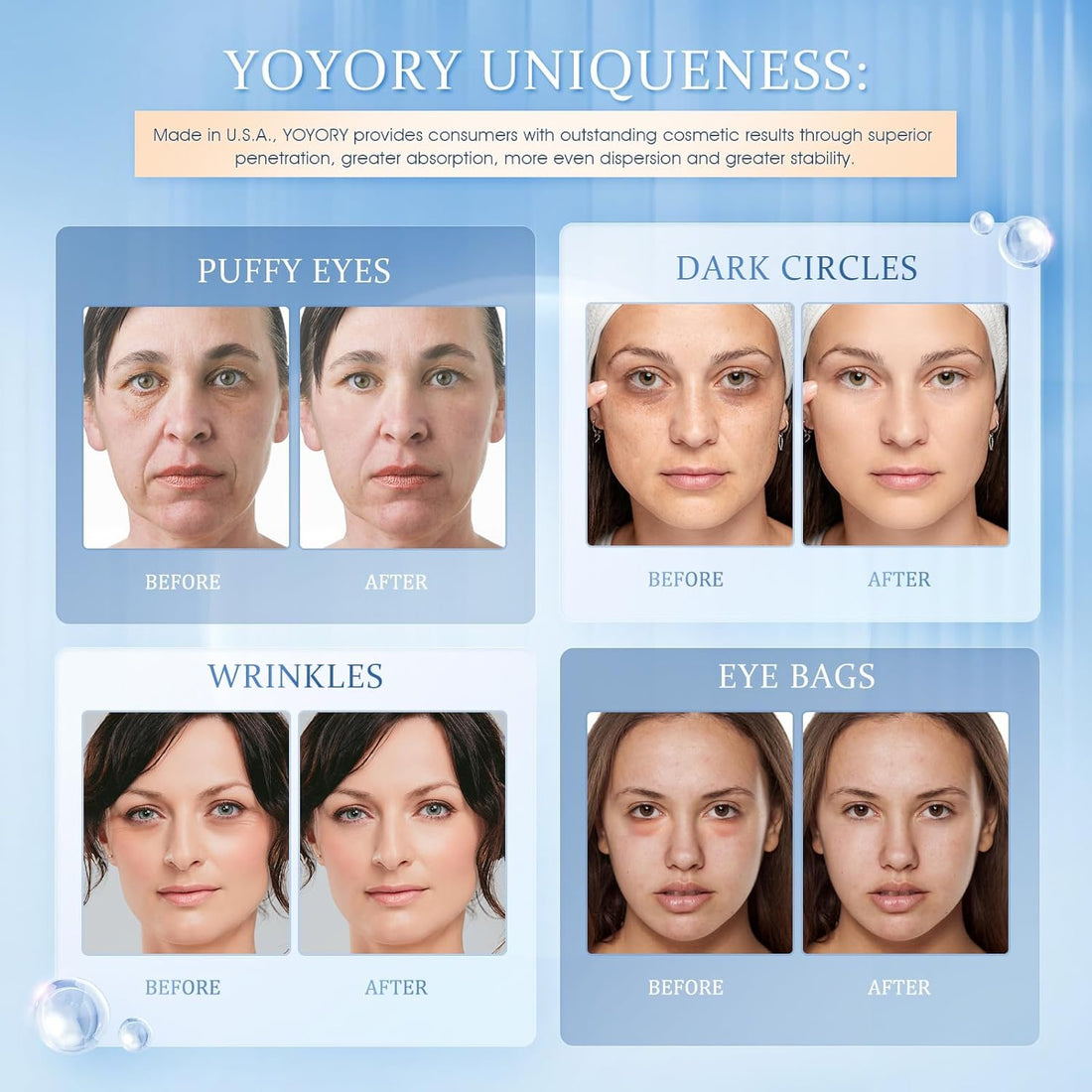 YOYORY Under Eye Patches - Eye Gel Masks for Wrinkles, Dark Circles, Puffy Eyes, Fine Lines, Eye Bags Treatment with Hyaluronic Acid Collagen, Moisturizing Hydrating 60Pcs,Blue
