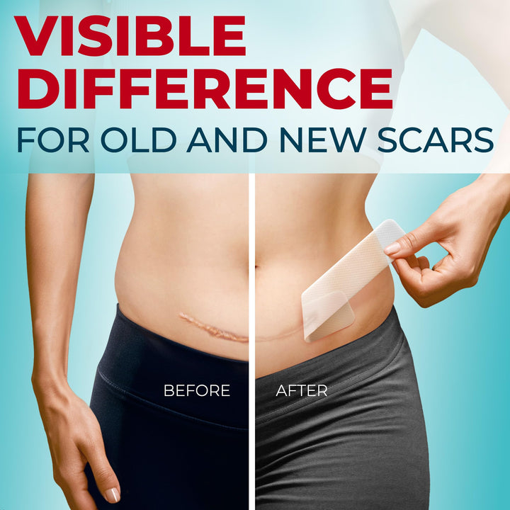Medical Grade Silicone Scar Tape - Transparent (1.6”x150”) - Visible Difference on Surgical & Keloid Scars - Reusable Silicone Scar Sheets - Easy to Use Silicone Tape for Scars