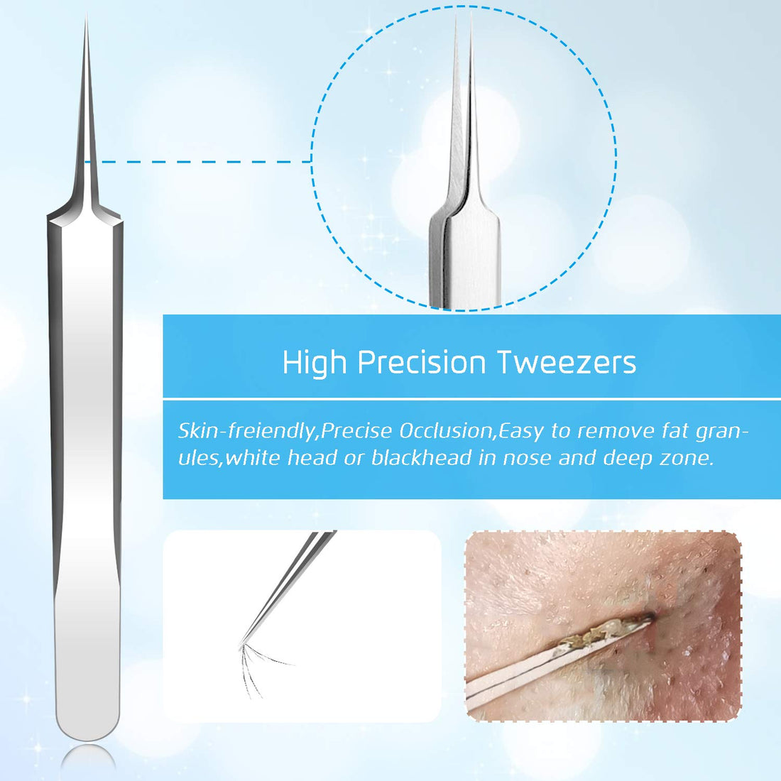 Blackhead Remover Pimple Extractor Tool, Terresa 8pcs Blackhead Extractor, Comedone Extractor Acne Removal Kit for Blemish, Whitehead Popping, Zit Removing for Nose Face, With Portable Box