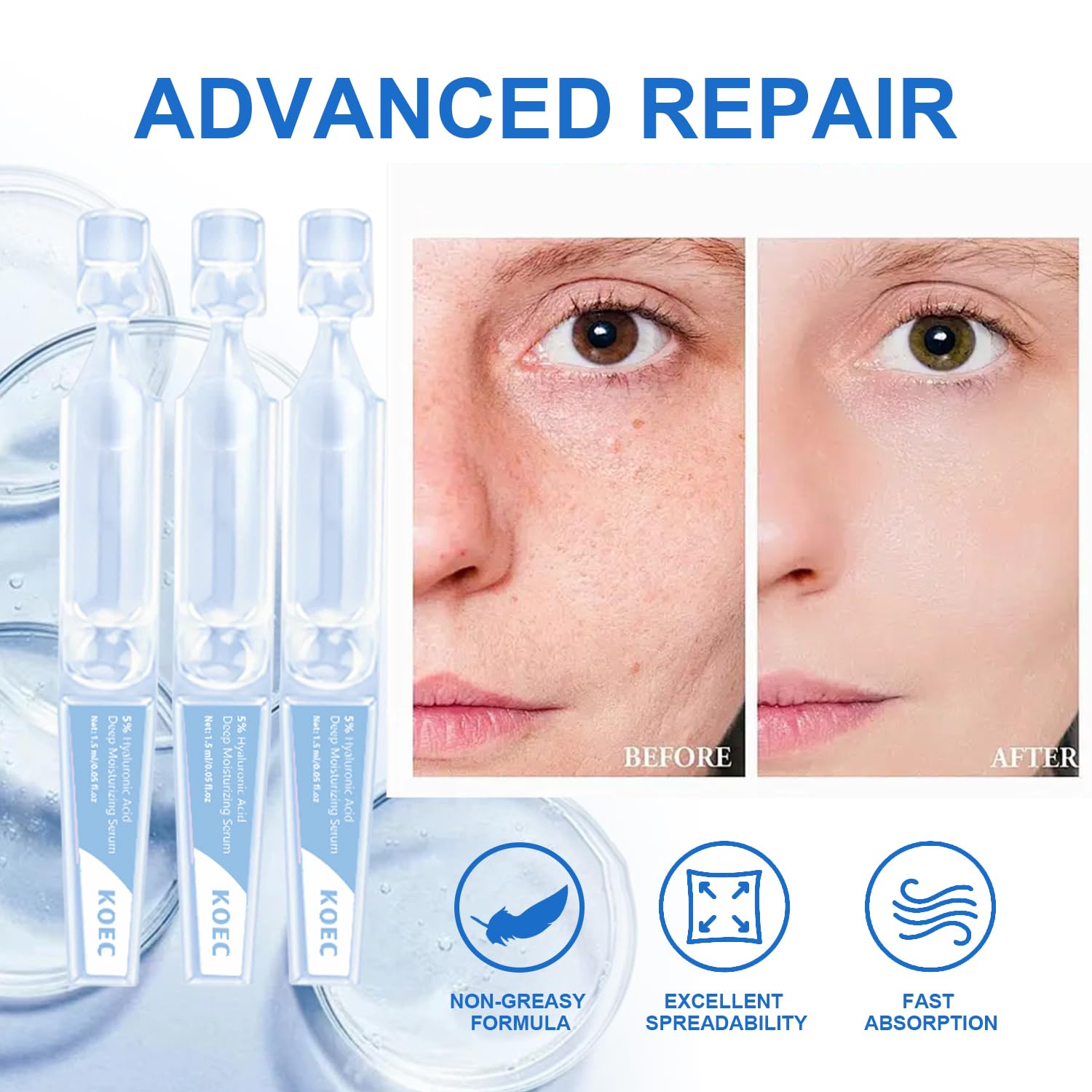 5% Hyaluronic Acid Serum Ultra-Moisturizing Vials,Hyaluronic Acid Facial Serum, Single-Use Hyaluronic Acid Tubes,Intensive Hydration,Enhances Skin Elasticity,Pre-Makeup Moisturizing Care (1 Box of 30)