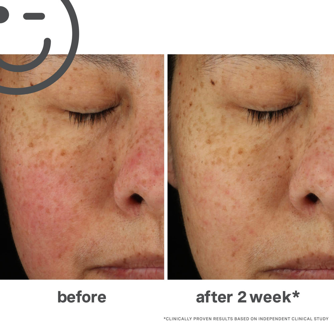 Kate Somerville KateCeuticals Total Repair Cream | Advanced Anti-Aging Moisturizer | Visibly Reduces Wrinkles & Fine Lines | 1 Fl Oz