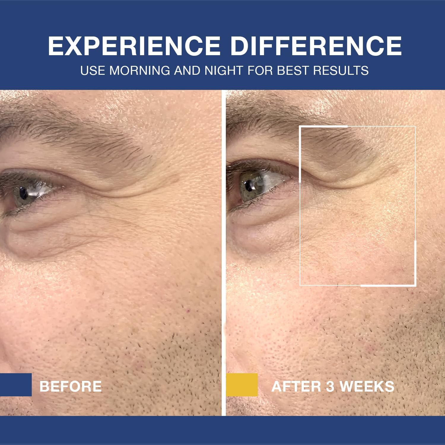 6 in 1 Face Cream for Men: 6 in 1 Mens Face Moisturizer, Mens Face Cream Anti Aging - Eye Bags Treatment & Wrinkle Cream for Men 1.7 oz