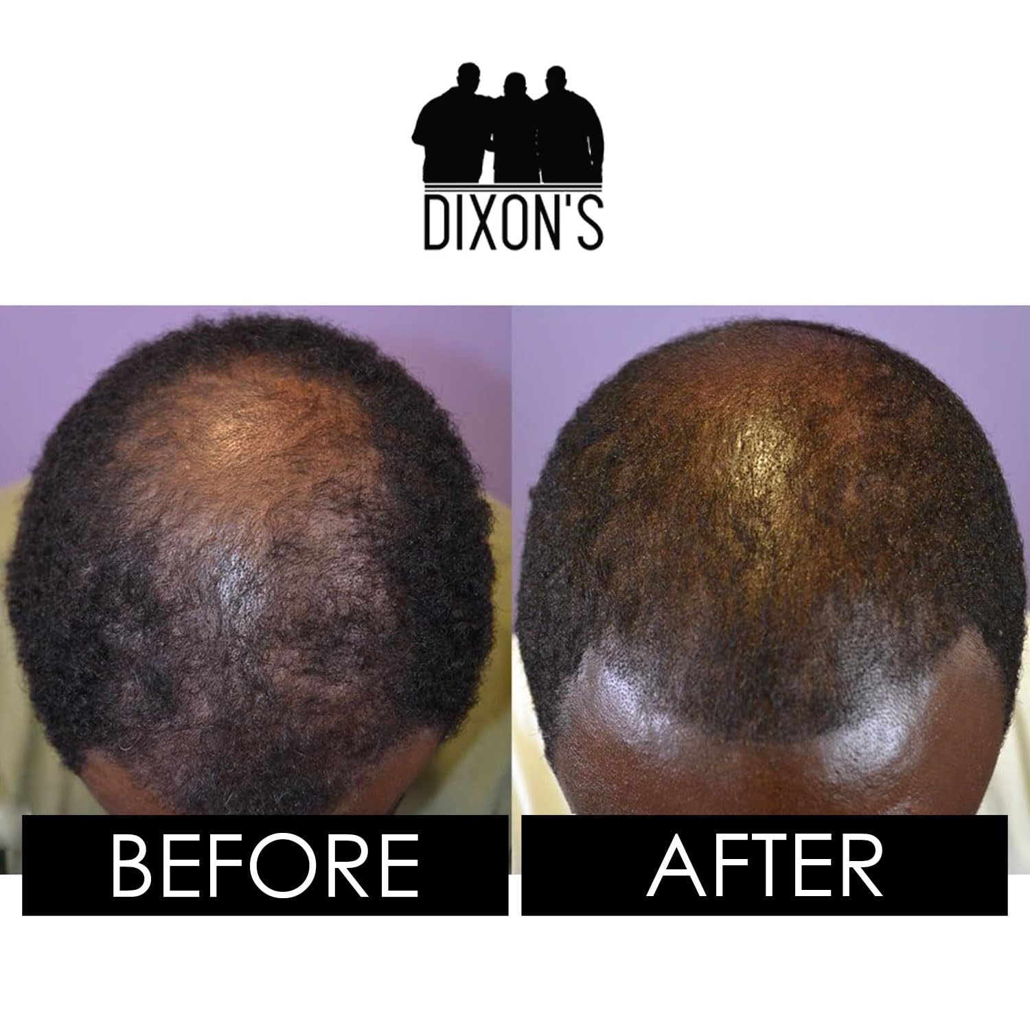 Dixon's 1737 Leave-In Conditioner, Daily Hair Moisturizer for Curly Hair, Damage Repair and Frizz Prevention Treatment (4 Fl oz)