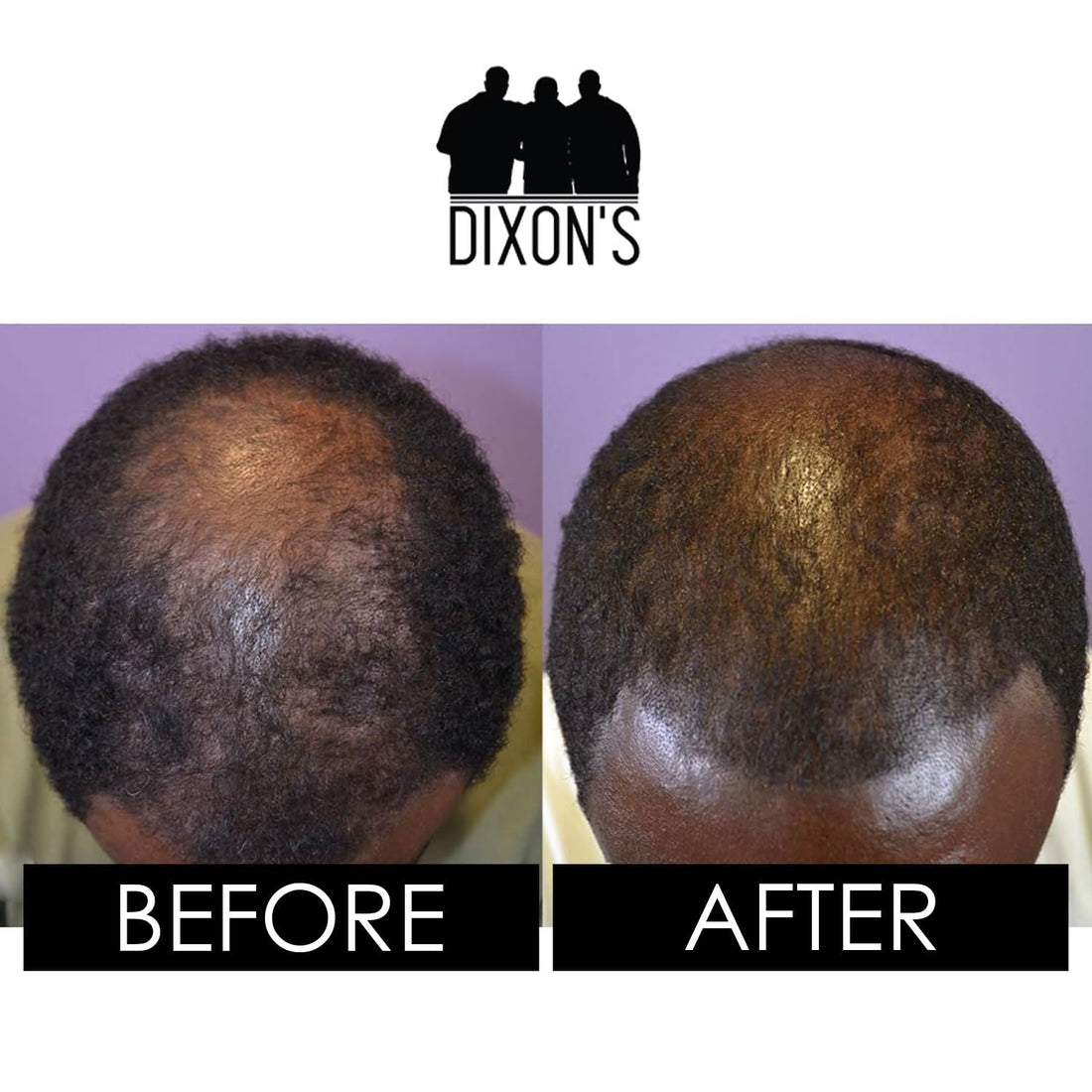 Dixon's 1737 Leave-In Conditioner, Daily Hair Moisturizer for Curly Hair, Damage Repair and Frizz Prevention Treatment (4 Fl oz)