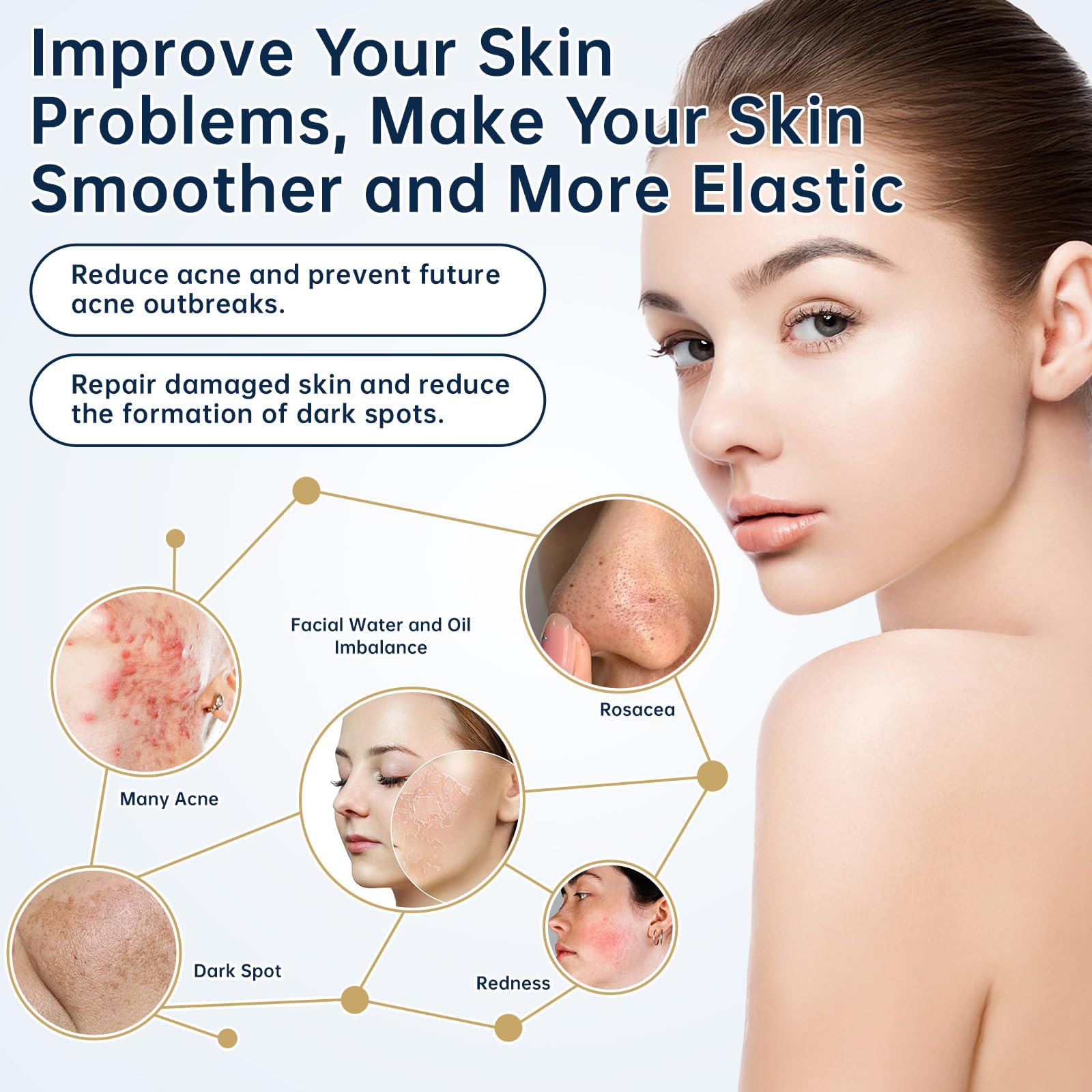 Azelaic Acid 14 Percent Cream For Face, Azelaic Acid Gel For Dark Spot, 30ML Azelaic Acid Acne Cream With Salicylic Acid, Niacinamide & Vitamin C, Relieve Irritation.