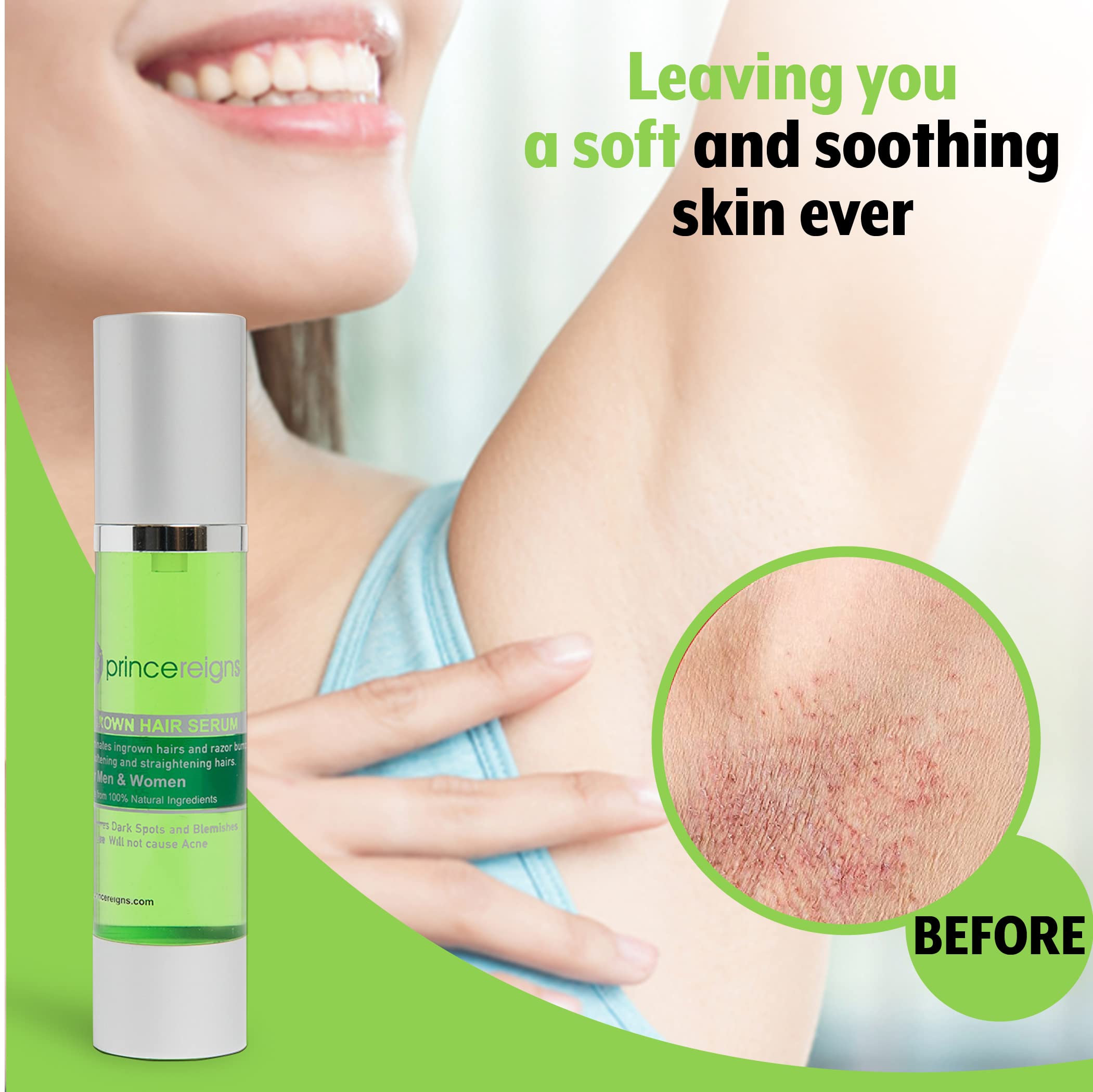 Organic Ingrown Hair and Razor Burn Serum (2 Pack) for Men and Women - Exfoliating AHA for Smooth Skin After Shaving, Waxing or Hair Removal, Preventing Bumps and Irritation