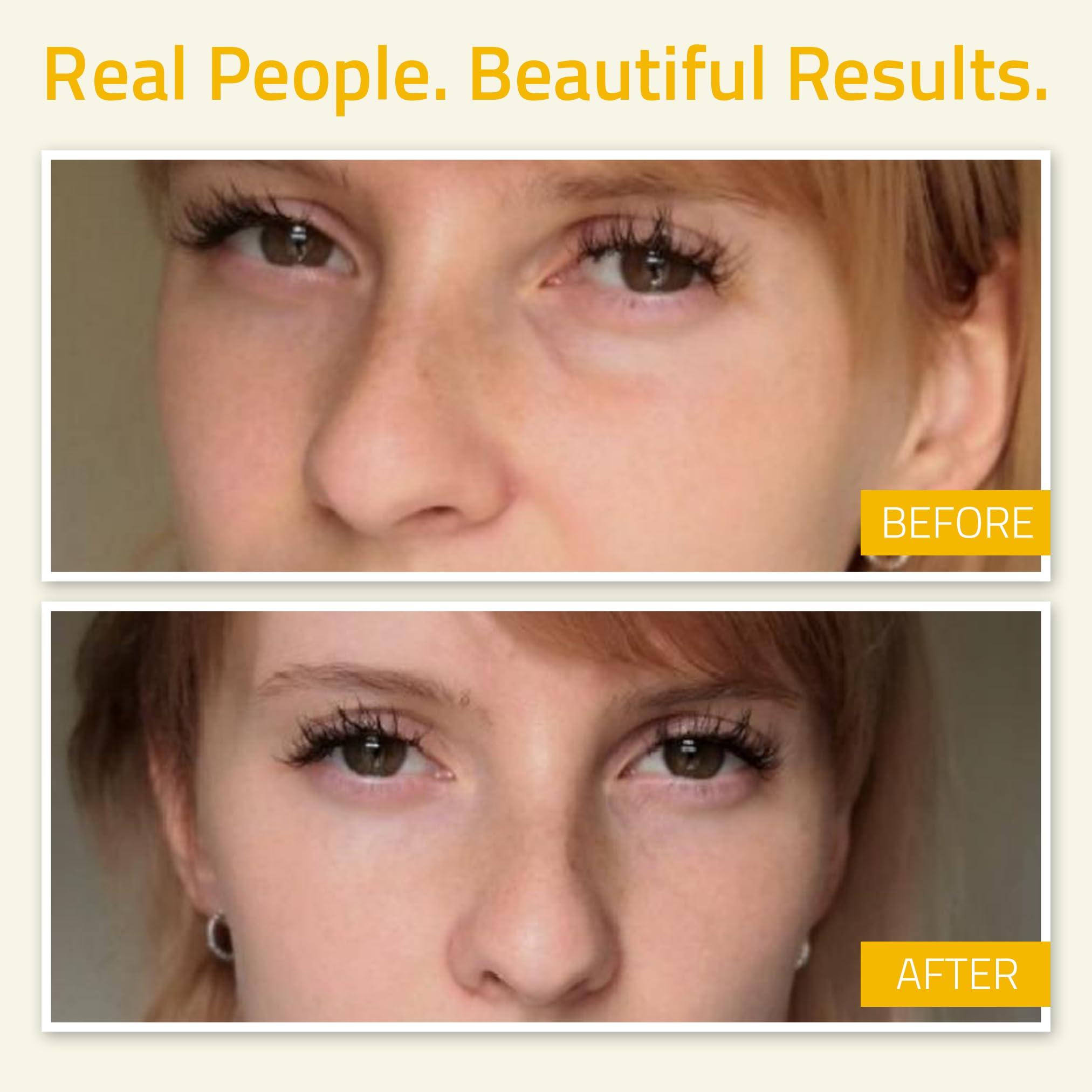 Anti Aging Eye Gel for Winkles, Dark Circles, Puffiness & Bags with Hyaluronic Acid and Tripeptide