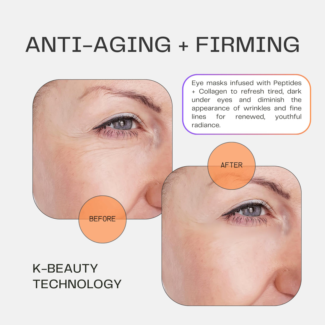 SkinFusion Collagen Under Eye Mask Patches (Anti-Aging + Firming, 20 Pairs) with Niacinamide + Peptides for Anti-Aging, Reduce Fine Lines, Wrinkles, Dark Circles, Puffy Eyes, Under Eye Bags - K Beauty