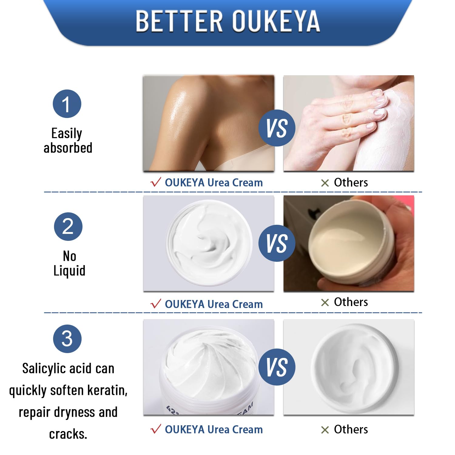 OUKEYA Urea Cream 42% plus Salicylic Acid 2% Net 5.29 Oz for Dry Cracked Feet, Heels, Knees, Elbows, Hands Repair Treatment. Moisturizes and Removes Corns, Calluses, Dead Skin, and Softens Toenails