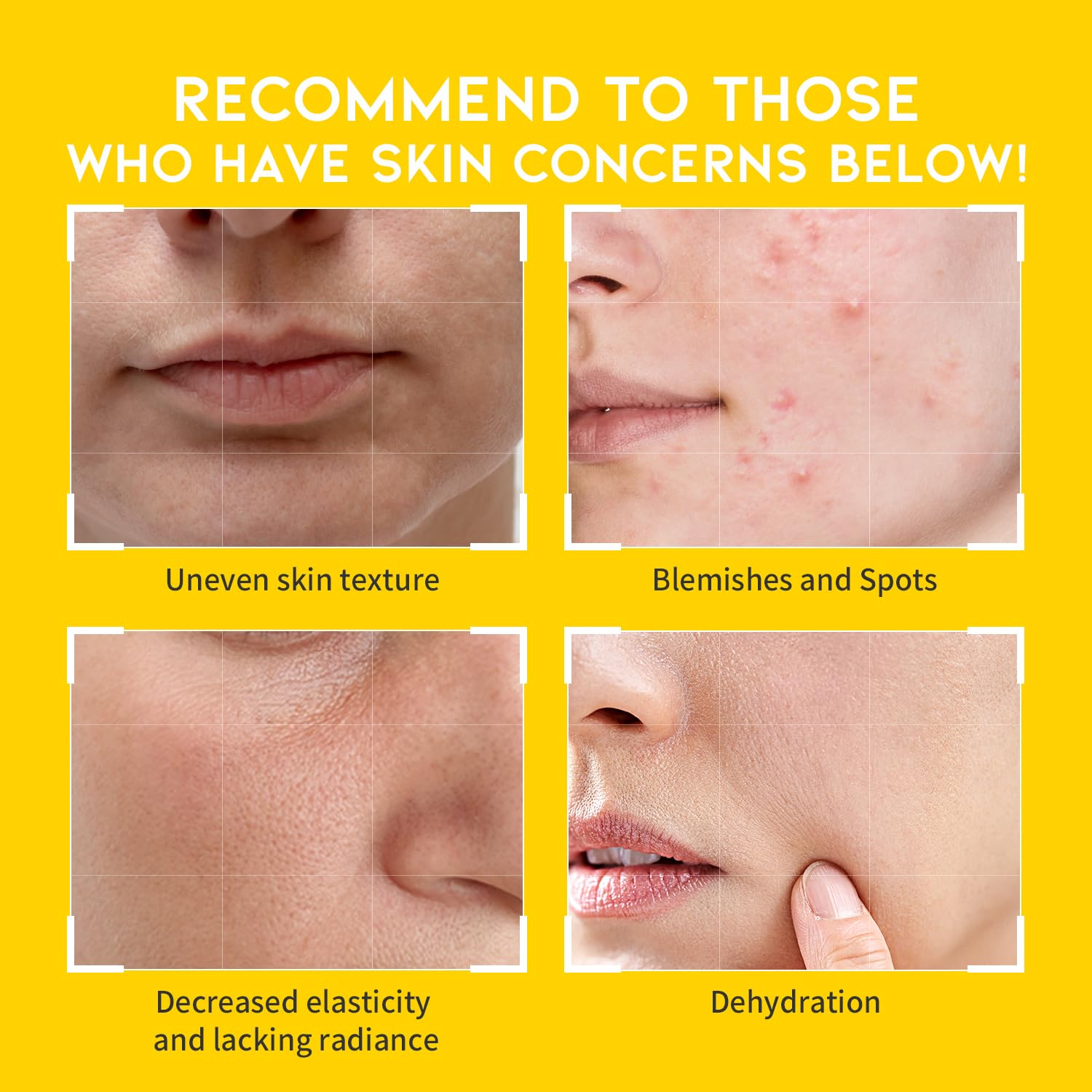 Boosting Toner Pads for Face Oily Skin Korean, #OOTD Vitamin C Niacinamide Heartleaf Hydrating Calming Redness, Vitamin C Toner Pad 70Pads 4.05oz 120ml