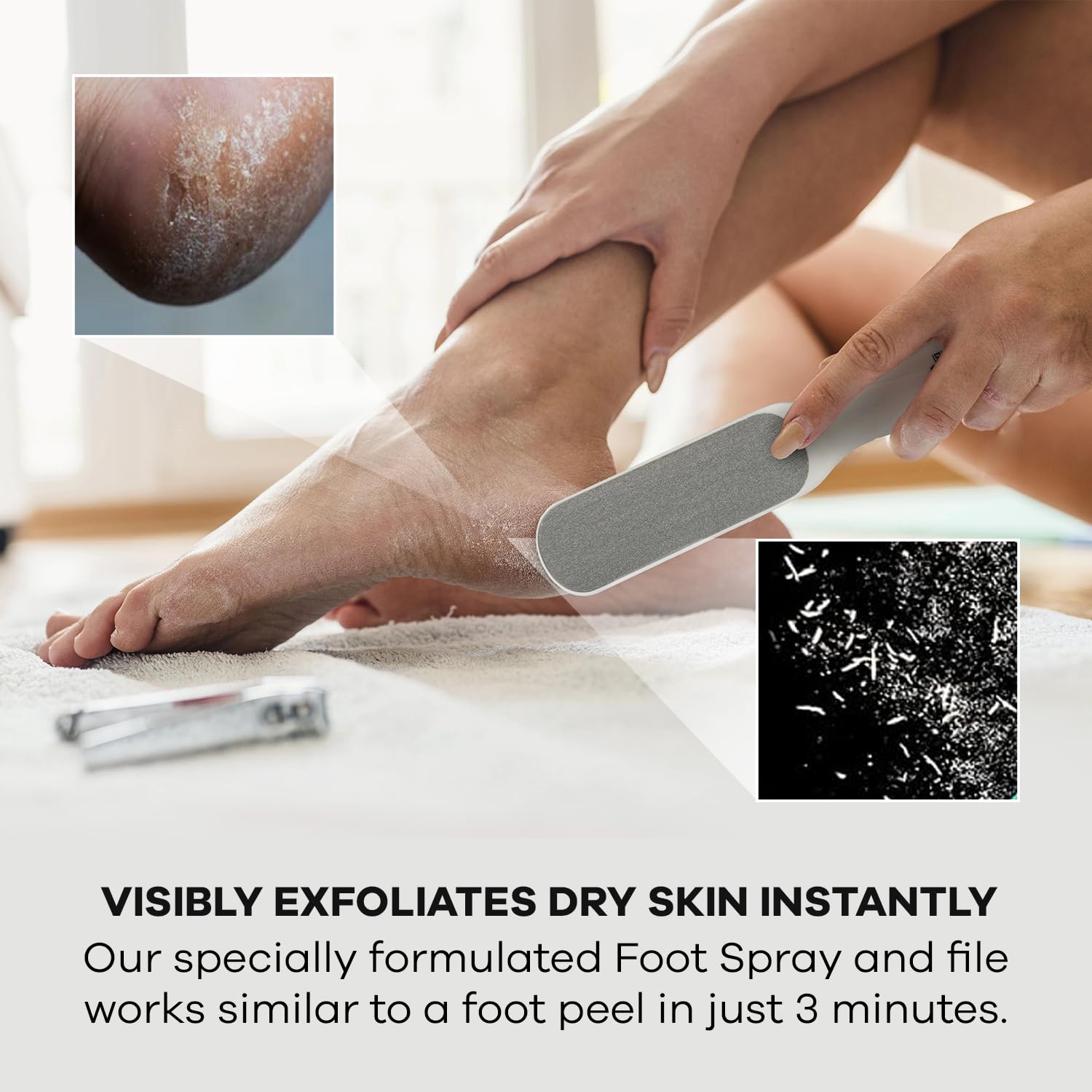 Dermasuri Callus Remover Foot Scrub - Exfoliating Feet Spray-on Formula and Reusable Deluxe Sole File - Dead Skin Remover, Callus Rasp, Scrubber, Peel & Soften Cracked Heels - Deluxe Pedicure Spa Kit