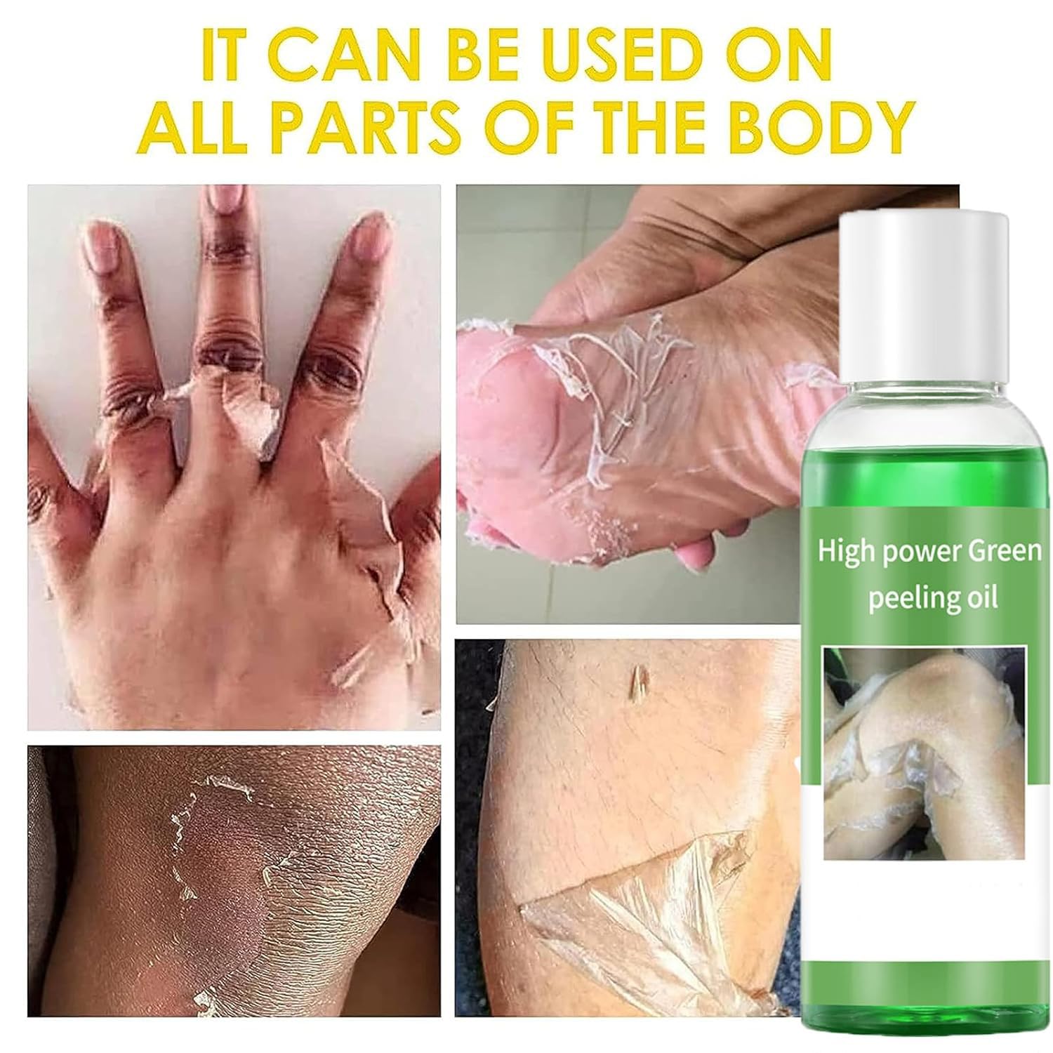 Generic Peeling Oil for Dark Skin, Green Peeling Oil Extra Strength, Extra Strong Peeling Oil for Hand, Feet and All Body, Chemical Peel for Face at Home,110ML/3.88Oz (2 PCS)