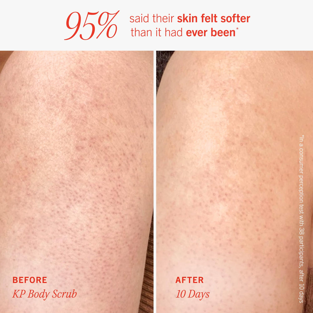 First Aid Beauty Smooth + Fresh Body Kit - Skin Care Gift Set with KP Bump Eraser Body Scrub, Whole Body Deodorant & Ingrown Hair Pads - Travel Friendly Skincare Set