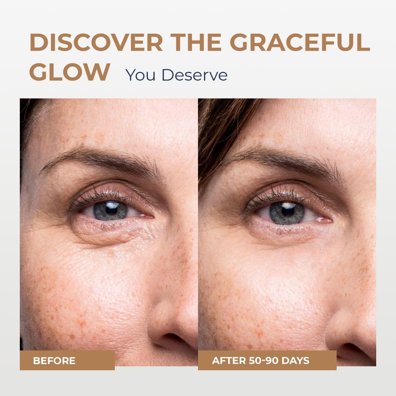 CARESILK Caffeine Eye Cream for Puffy Eyes Treatment + Hyaluronic Acid & Squalane - Under Eye Cream, Dark Circles Under Eye Treatment, Under Eye Corrector Serum - 0.5oz