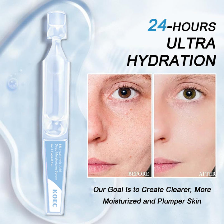 5% Hyaluronic Acid Serum, Ultra Hydrating Serum, Nature Perfection Hyaluronic Acid for Face Serums Hydrated, Anti-Aging, Rejuvenates Skin (1.52 Fl Oz (Pack of 1))