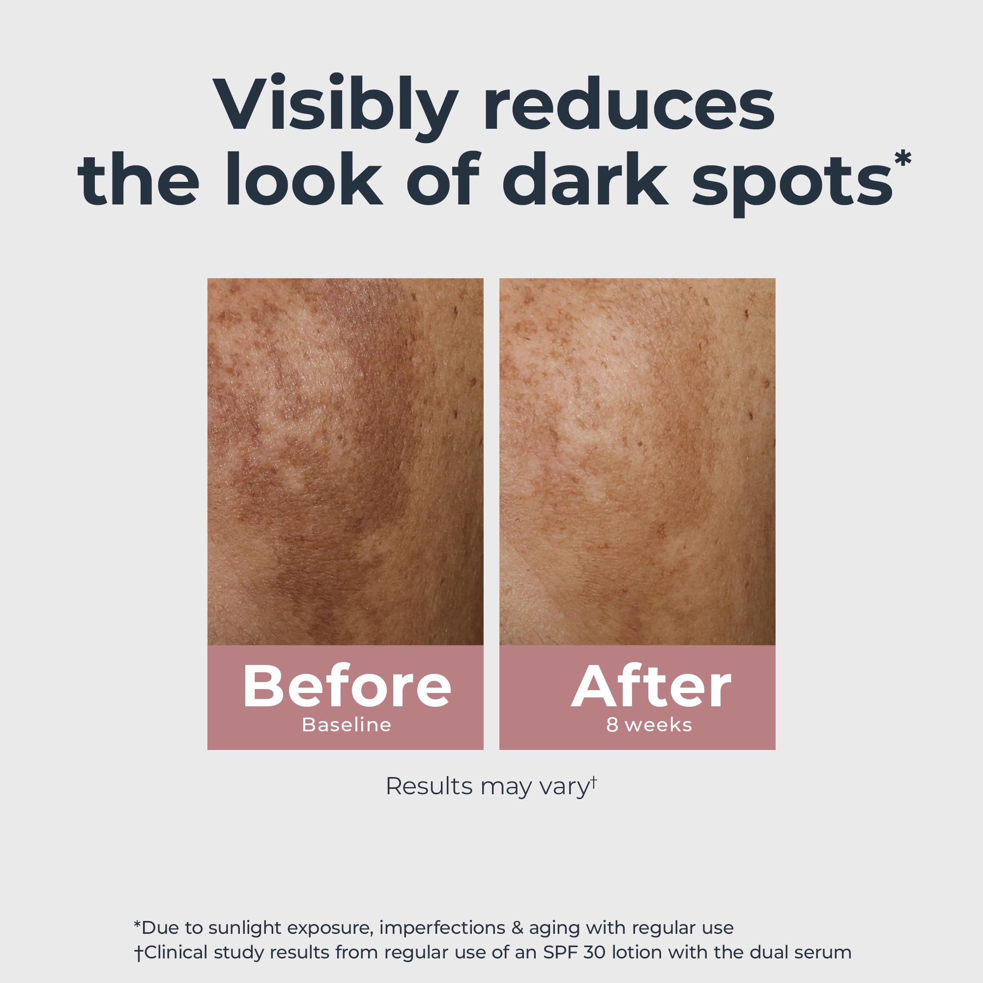 Eucerin Radiant Tone Dual Serum Dark Spot Corrector, Dark Spot Serum with Thiamidol and Hyaluronic Acid, Helps Visibly Reduce the Look of Persistent Dark Spots, 1 Fl Oz Bottle