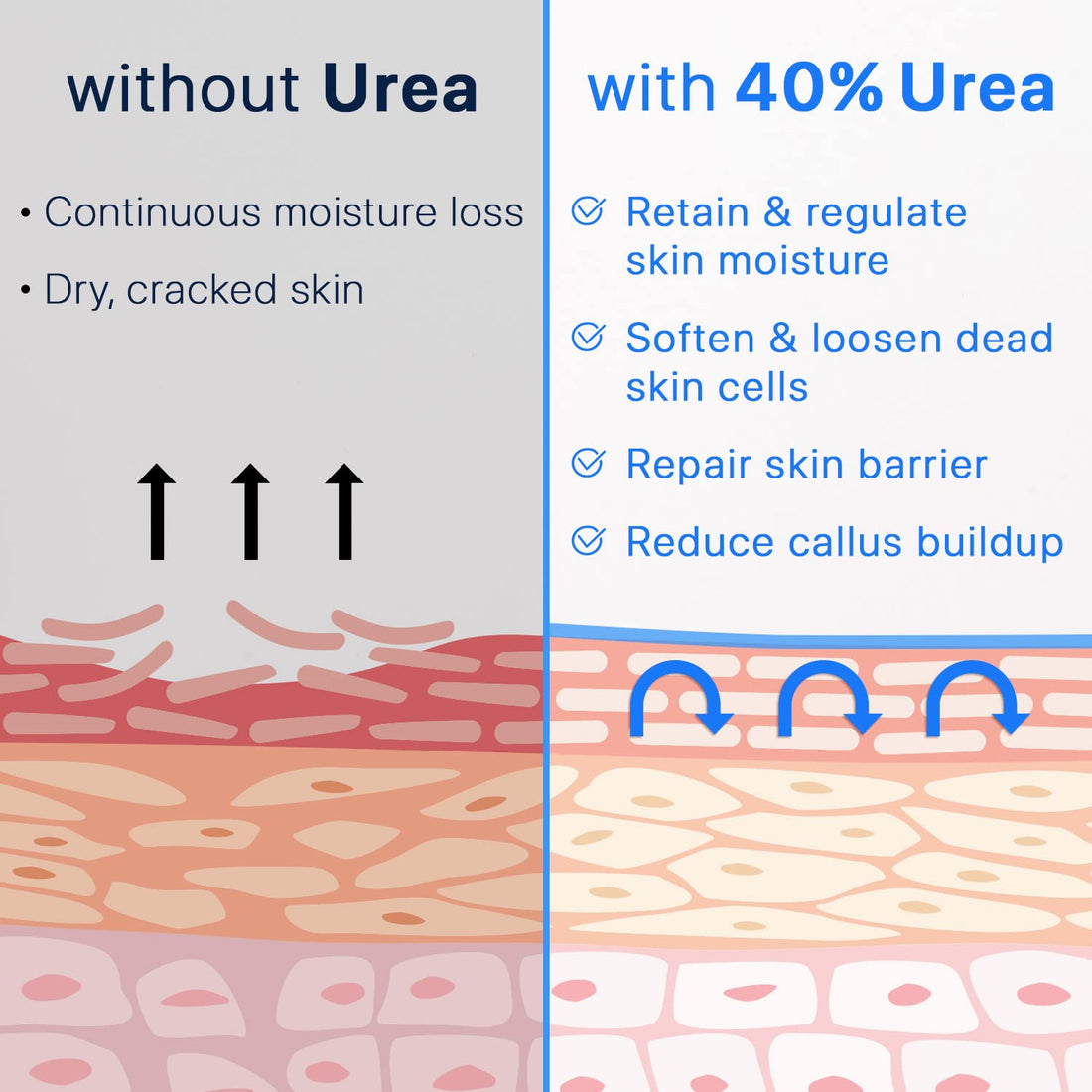 Ebanel Urea Cream 40% Plus Salicylic Acid 4.6 Oz, Callus Remover Hand Cream Foot Cream For Dry Cracked Feet, Hands, Heels, Knees, Intensive Moisturizes & Softens Skin, Exfoliates Dead Skin