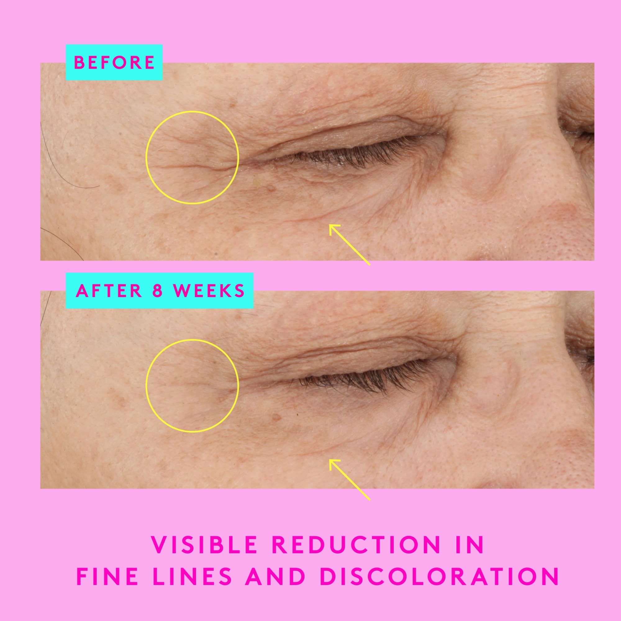 Drunk Elephant A-Shaba Complex Eye Serum - 15 ml/.5 fl oz - .1% Retinol Eye Cream - Clean Clinical Skincare - Cruelty-Free - Dermatologist-Tested - Free of Essential Oils, Silicones, and Fragrance