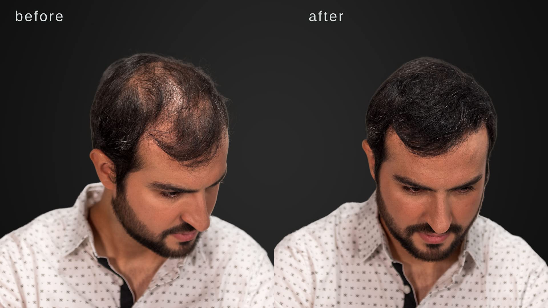 LUXE Hair Thickening Fibers with Natural Keratin-2 Months+ Supply!-Confidence in a Jar!-Multiple Colors Available (Light Brown) by LUXE