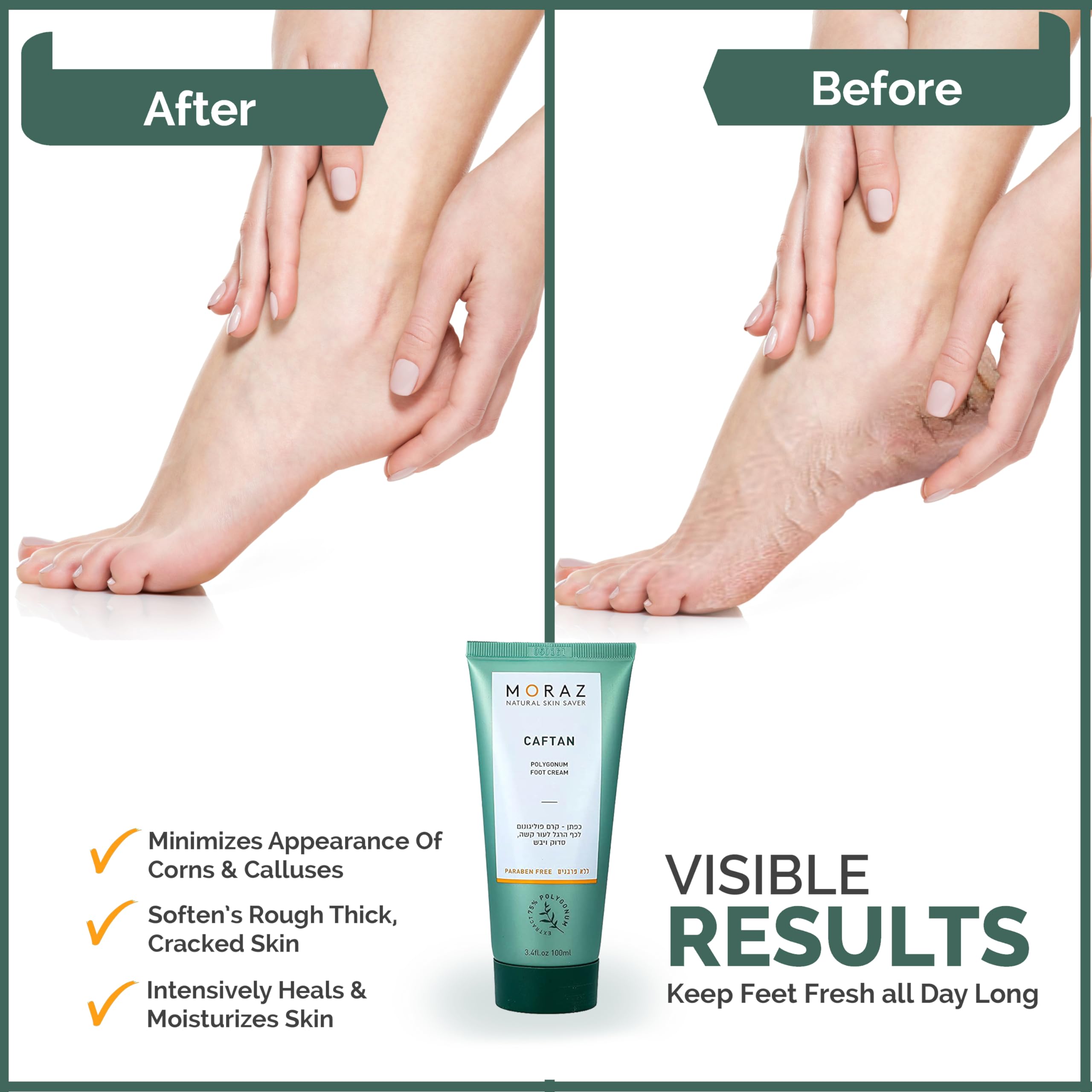 Herbal Foot Cream For Dry Skin By Moraz | 50 Ml | For Treating The Intensive Care For Extremely Dry Feet, Rough Patches And Cracked Heels. Easy & Quick Absorption. Wonderful Fragrance.