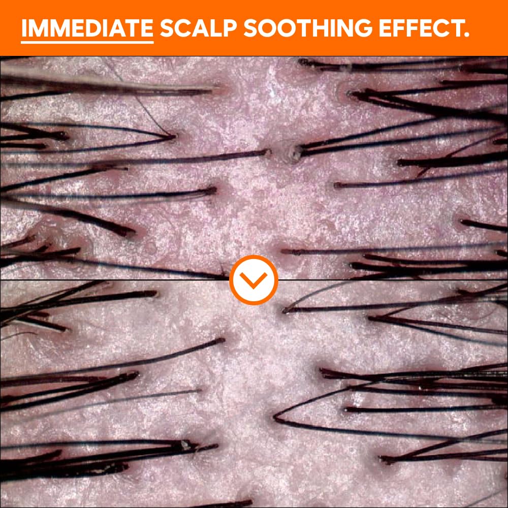 CHUNGMIJUNG Conditioning Kelp Shampoo – Scalp Care & Gentle Cleansing with Laminaria Japonica & Centella Asiatica – Korean Haircare for Sensitive Scalp & Dry Hair, 500ml / 16.9 fl.oz.