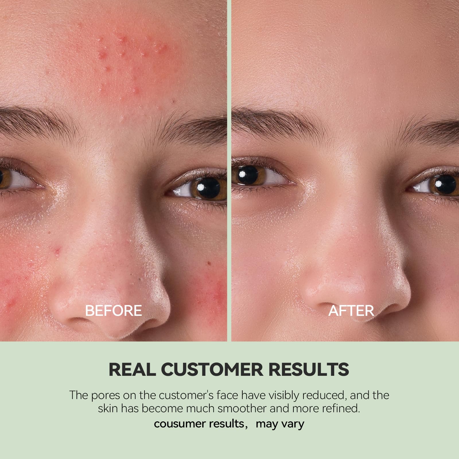 WNP Duo Cleansing Clay Mask with Niacinamide & Hyaluronic Acid – Deep Pore Cleanser for T-Zone & U-Zone, Blackhead Remover, Hydrating & Oil-Control Face Mask, 3.53oz