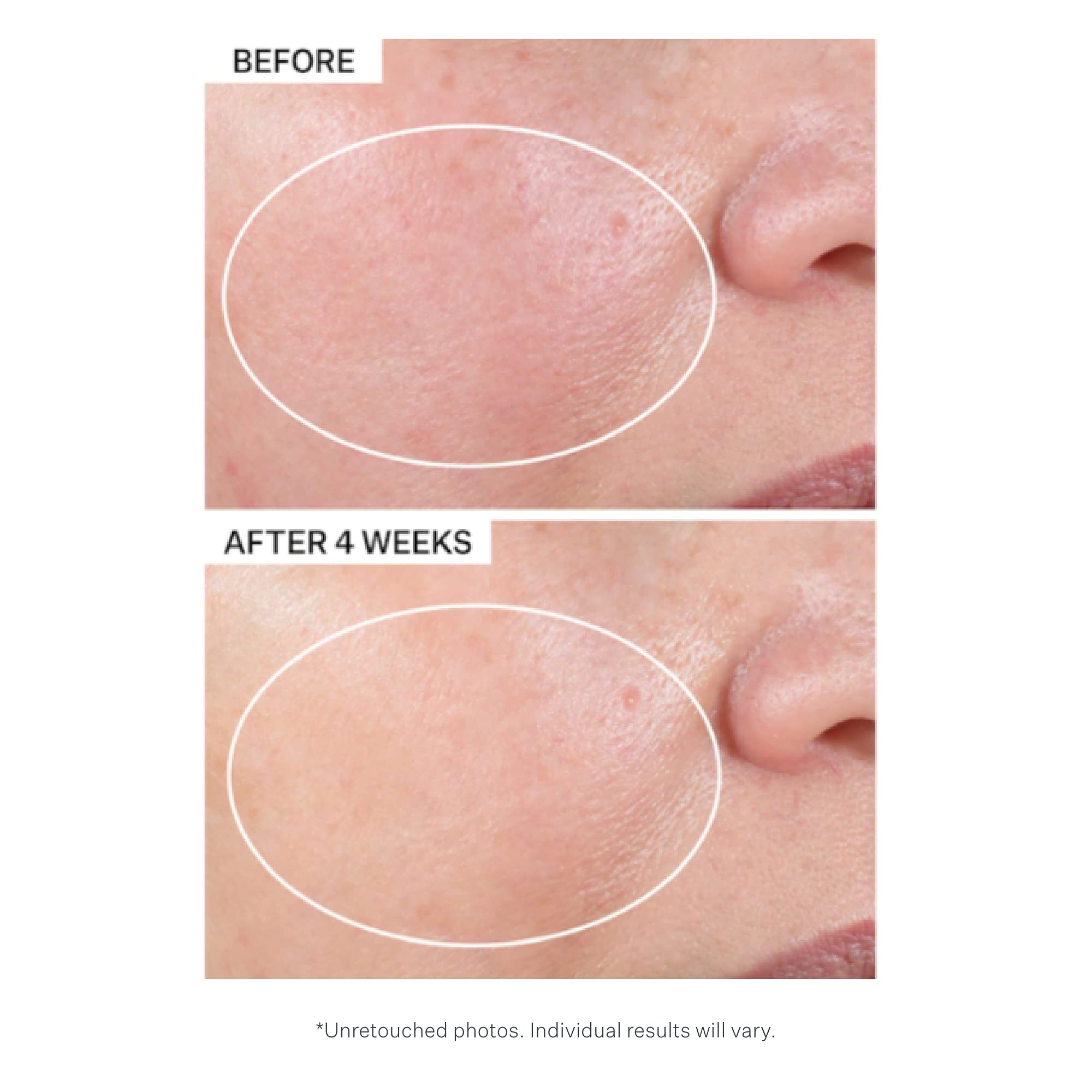 StriVectin Advanced Retinol Intensive Night Moisturizer, 1.1 oz.