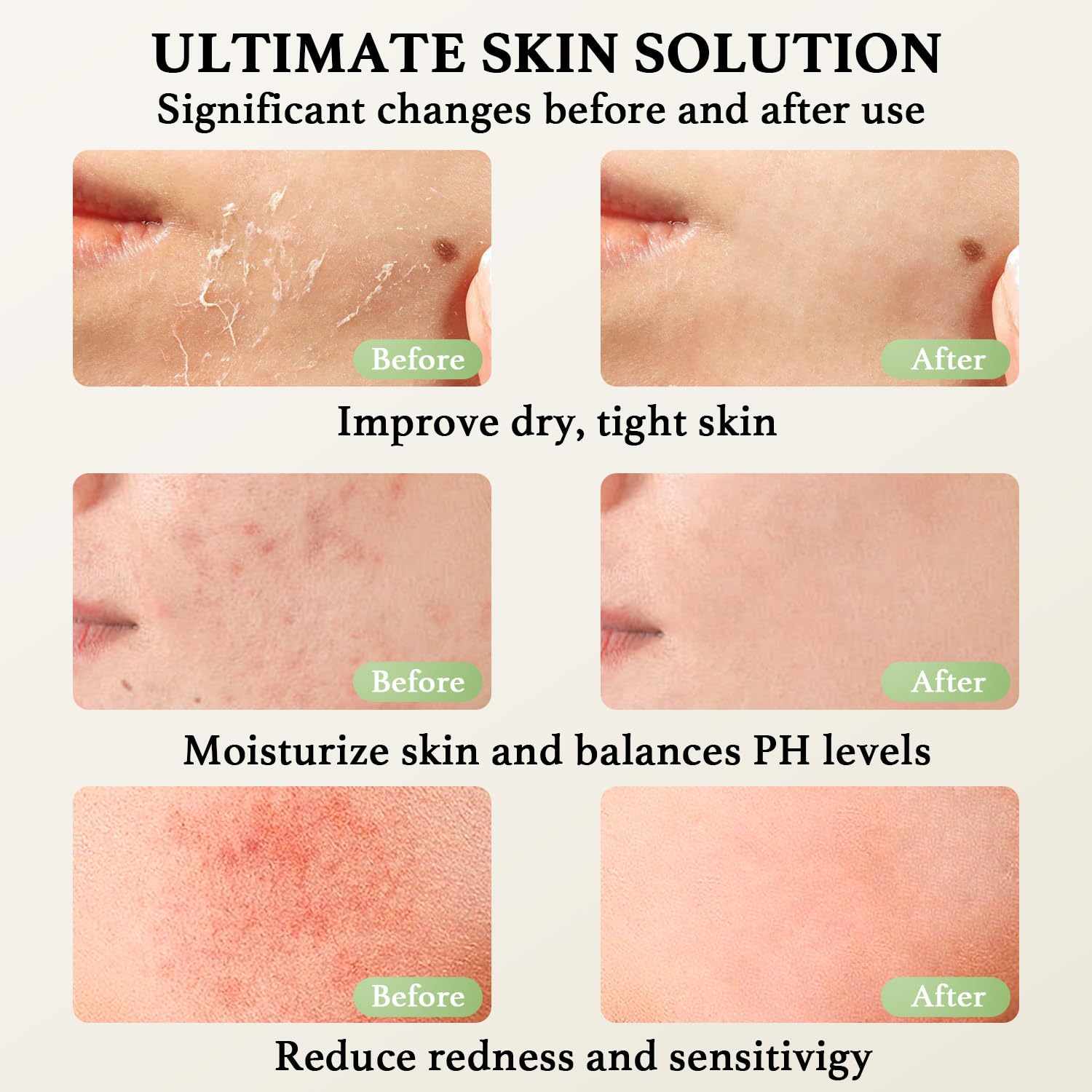 Beef Tallow for Skin, Beef Tallow and Honey Balm, Natural Tallow Face Moisturizer, Grass Fed Organic Tallow Face Cream Moisturizer Body Lotion Skin Care for Sensitive Skin - 4.2 oz