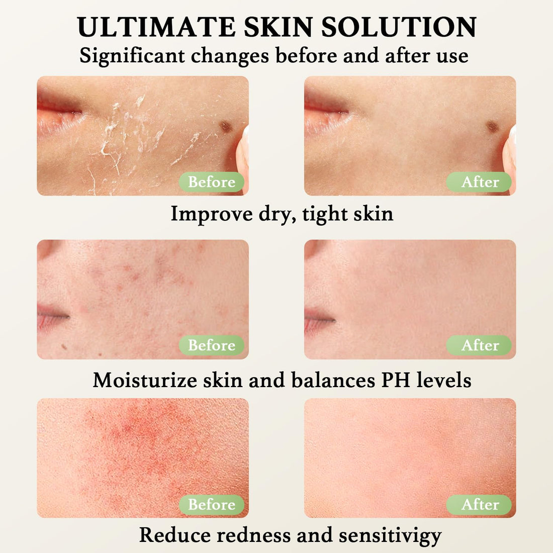 Beef Tallow for Skin, Beef Tallow and Honey Balm, Natural Tallow Face Moisturizer, Grass Fed Organic Tallow Face Cream Moisturizer Body Lotion Skin Care for Sensitive Skin - 4.2 oz