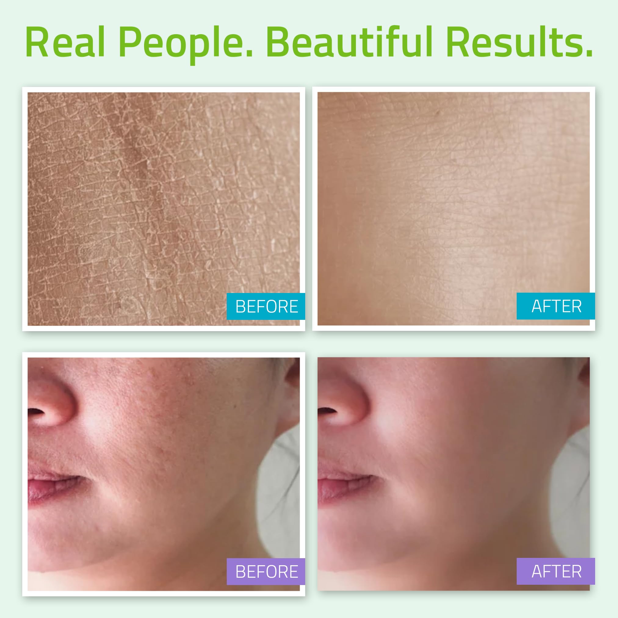 YEOUTH Teen Skin Kit Starter Set - Anti Aging Beauty Essentials - Vitamin C Facial Cleanser - Balancing Facial Toner for Face - Pure Hyaluronic Acid Serum - Day and Night Snail Cream Moisturizer