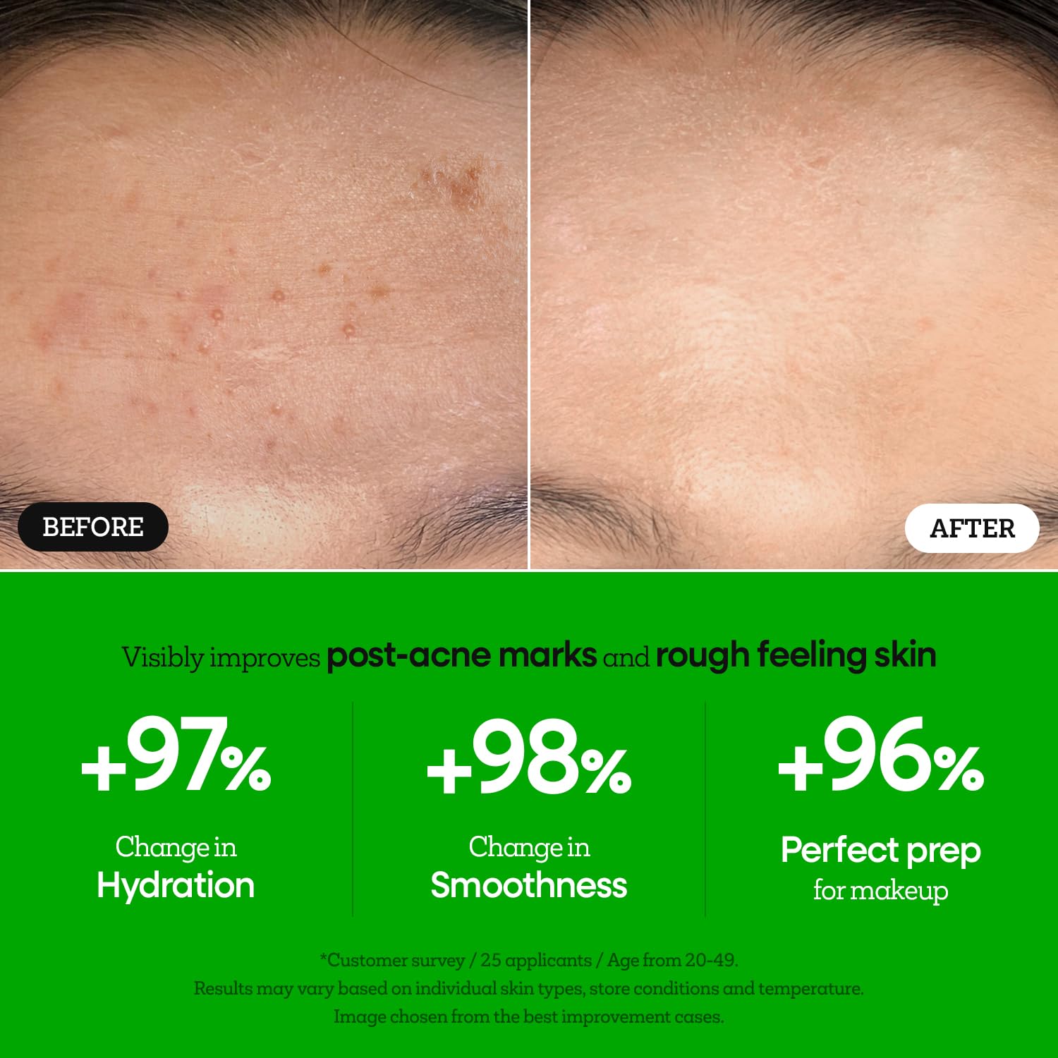 Nature Republic The First Peptide Boosting Serum, 8 Peptides, Niacinamide & Triple Hyaluronic Acid Complex,17 Amino acids,for All Skin Types, Korean Skin Care150ml/5.07 fl oz