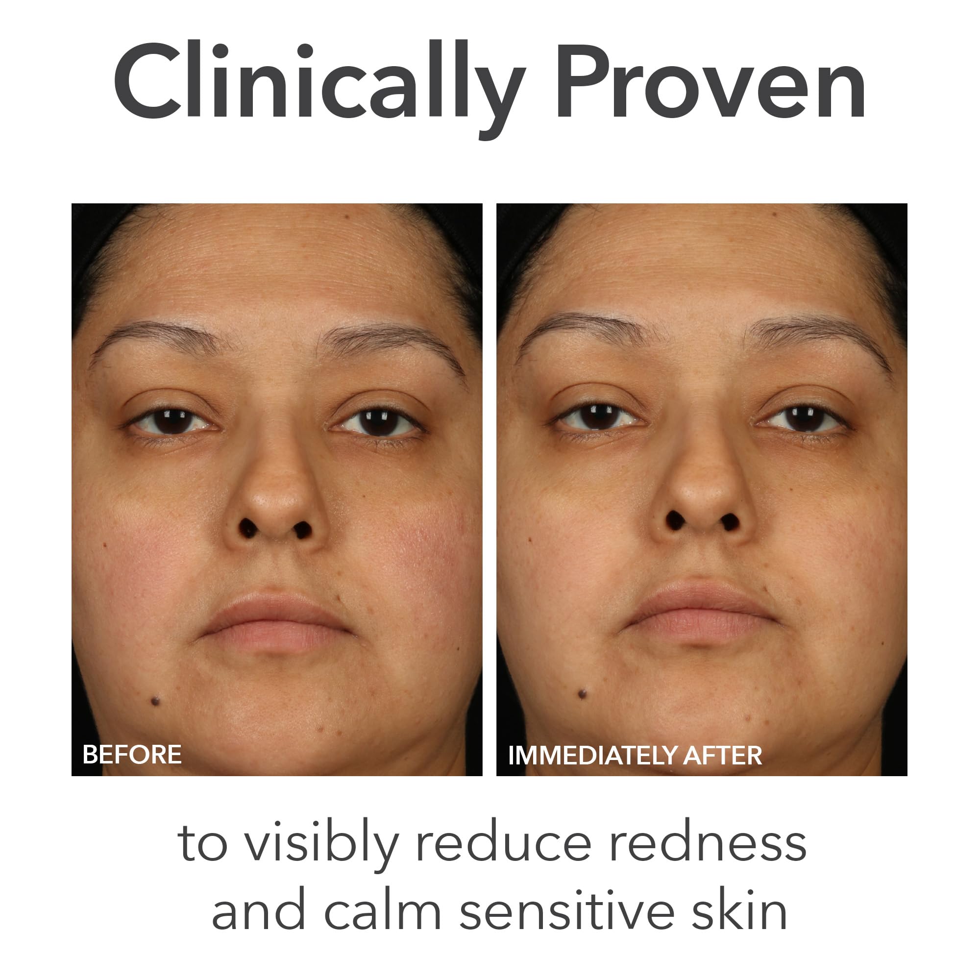 Dr Dennis Gross Alpha Beta pH Balance Replenishing Cream – Lightweight Gel-Cream with Electrolytes, Phytic Acid & AHAs - Hydrates, Soothes & Balances Skin, 1.7 fl oz