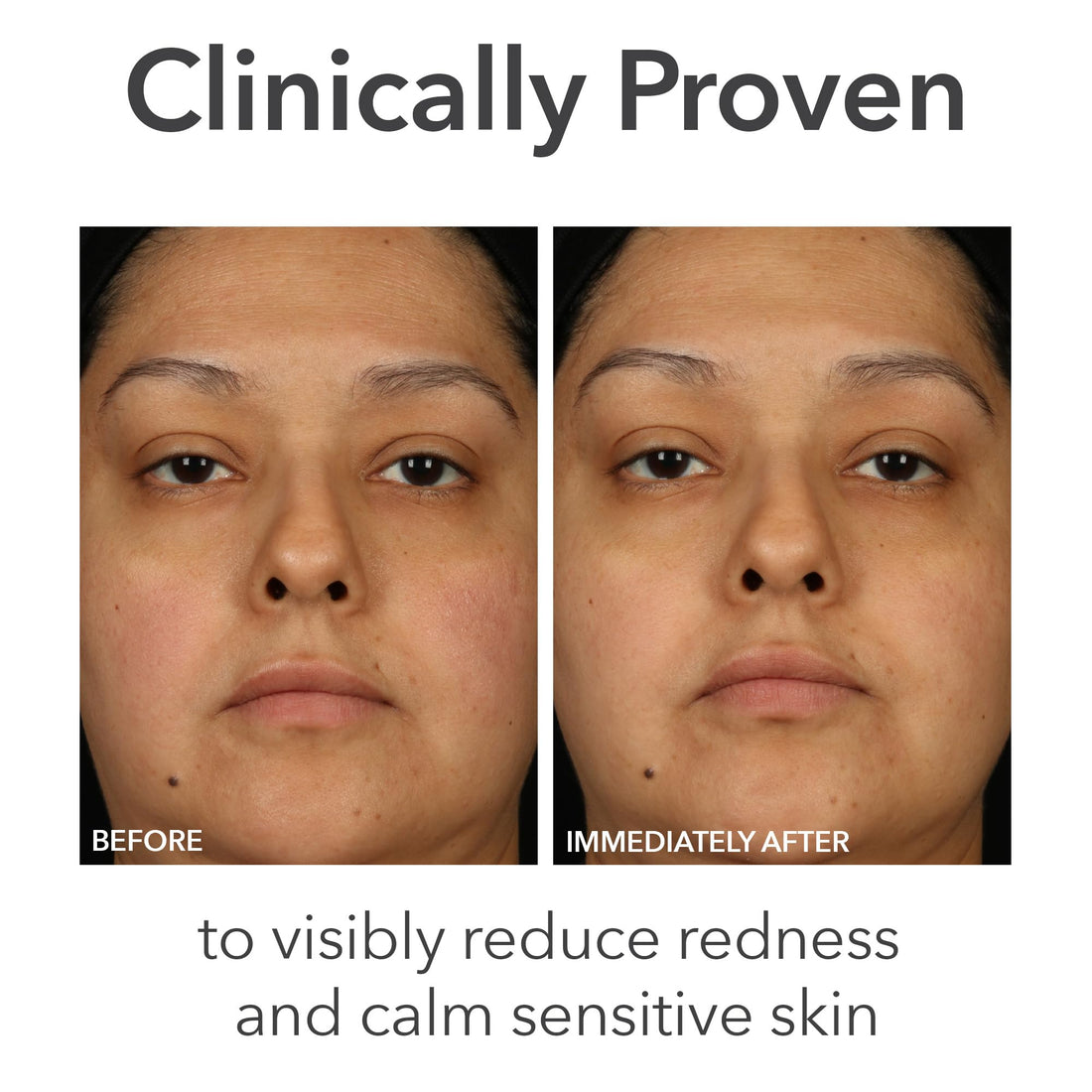 Dr Dennis Gross Alpha Beta pH Balance Replenishing Cream – Lightweight Gel-Cream with Electrolytes, Phytic Acid & AHAs - Hydrates, Soothes & Balances Skin, 1.7 fl oz