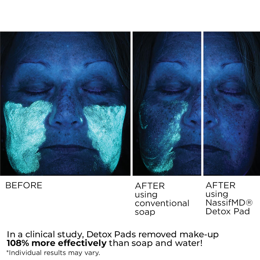 NassifMD Exfoliating Detox Pads, AHA Pads Formulated with Glycolic Acid, Witch Hazel, and Salicylic Acid