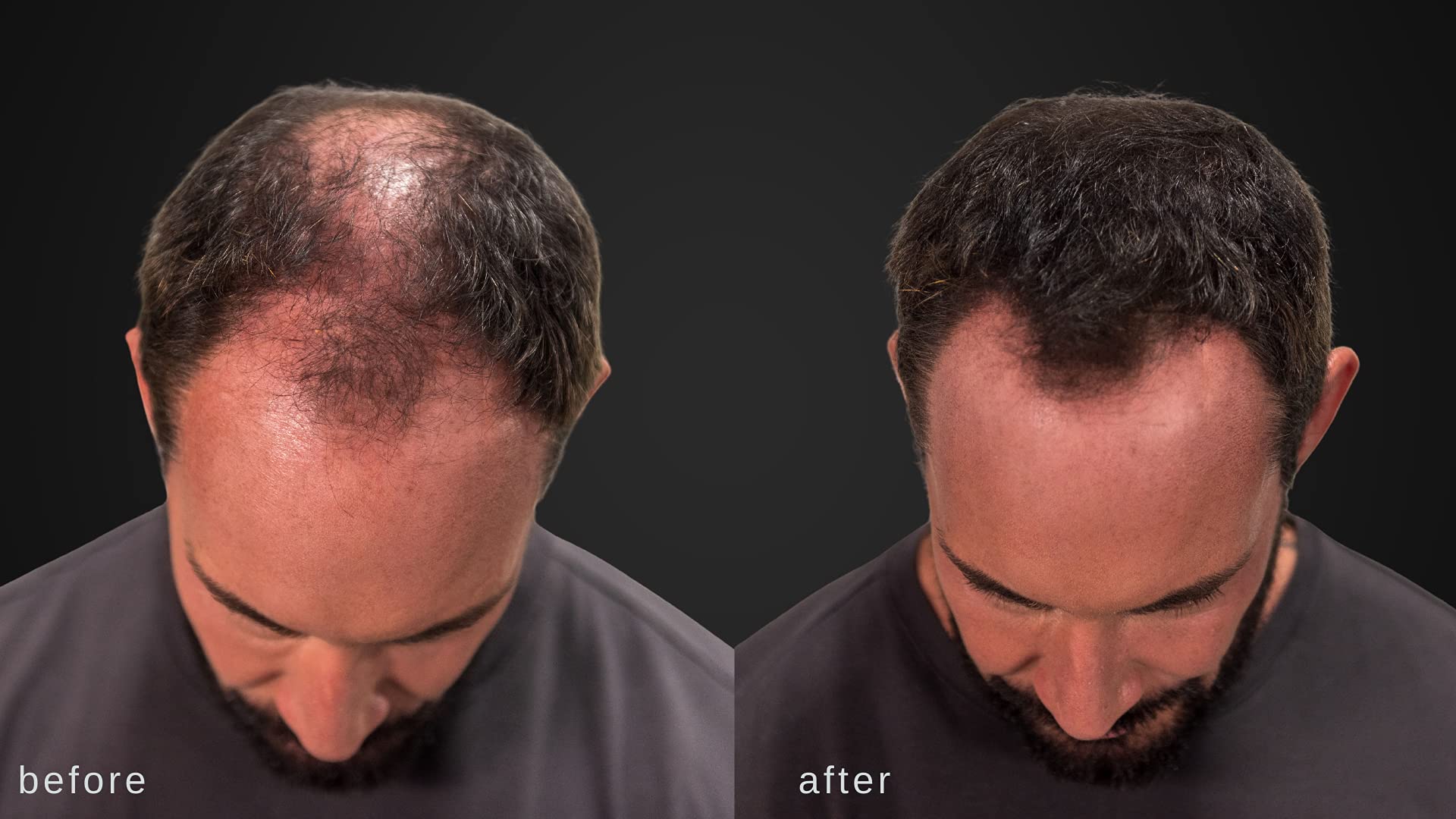 LUXE Hair Thickening Fibers with Natural Keratinâ€“2 Months+ Supply!â€“Confidence in a Jar!â€“Multiple Colors Available (Medium Blond)