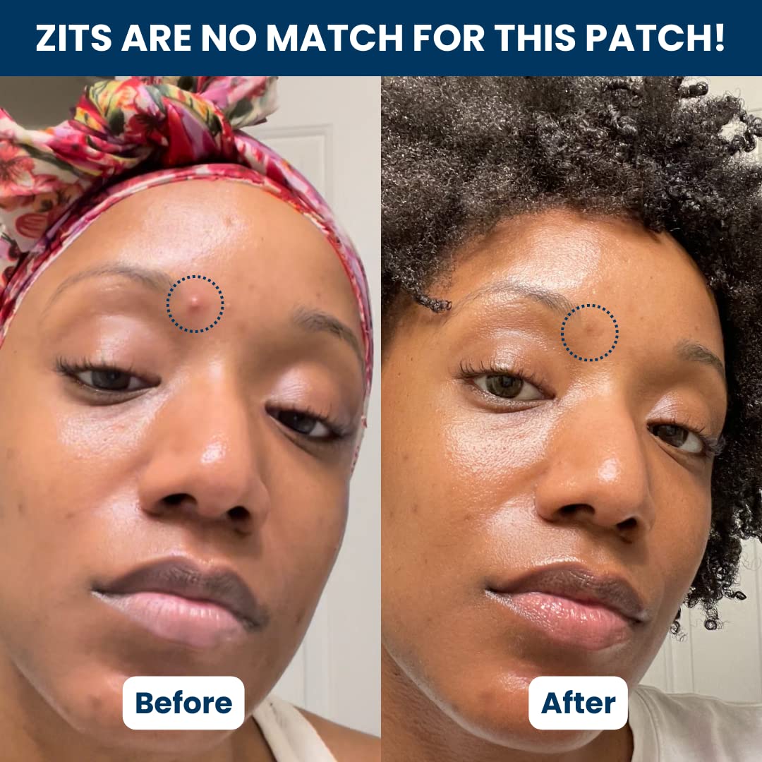 Clean Skin Club 60 Invisible Vegan Pimple Patches, Derma Dot Hydrocolloid for Covering Zits, Blackhead, Blemish, Absorbing Face Cover Sticker, Skincare Treatment, Non Toxic Ingredients