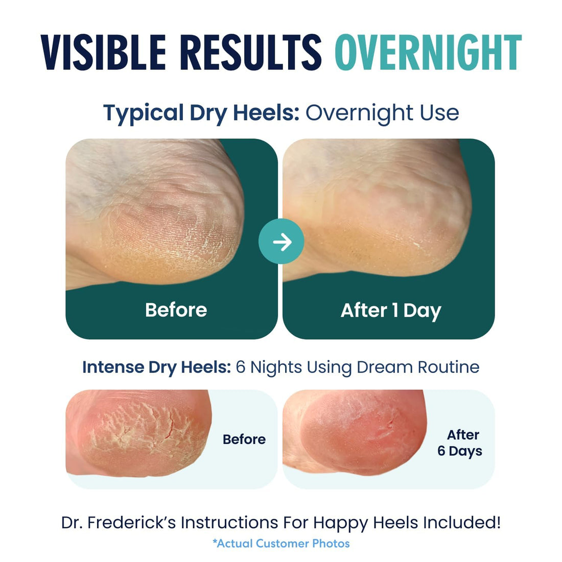 Dr. Frederick's Original Moisturizing Heel Socks for Cracked Heel Treatment - 2 Pairs - Socks for Dry Feet - Cracked Skin Repair & Overnight Hydration - Foot Care for Women & Men - Jojoba Oil