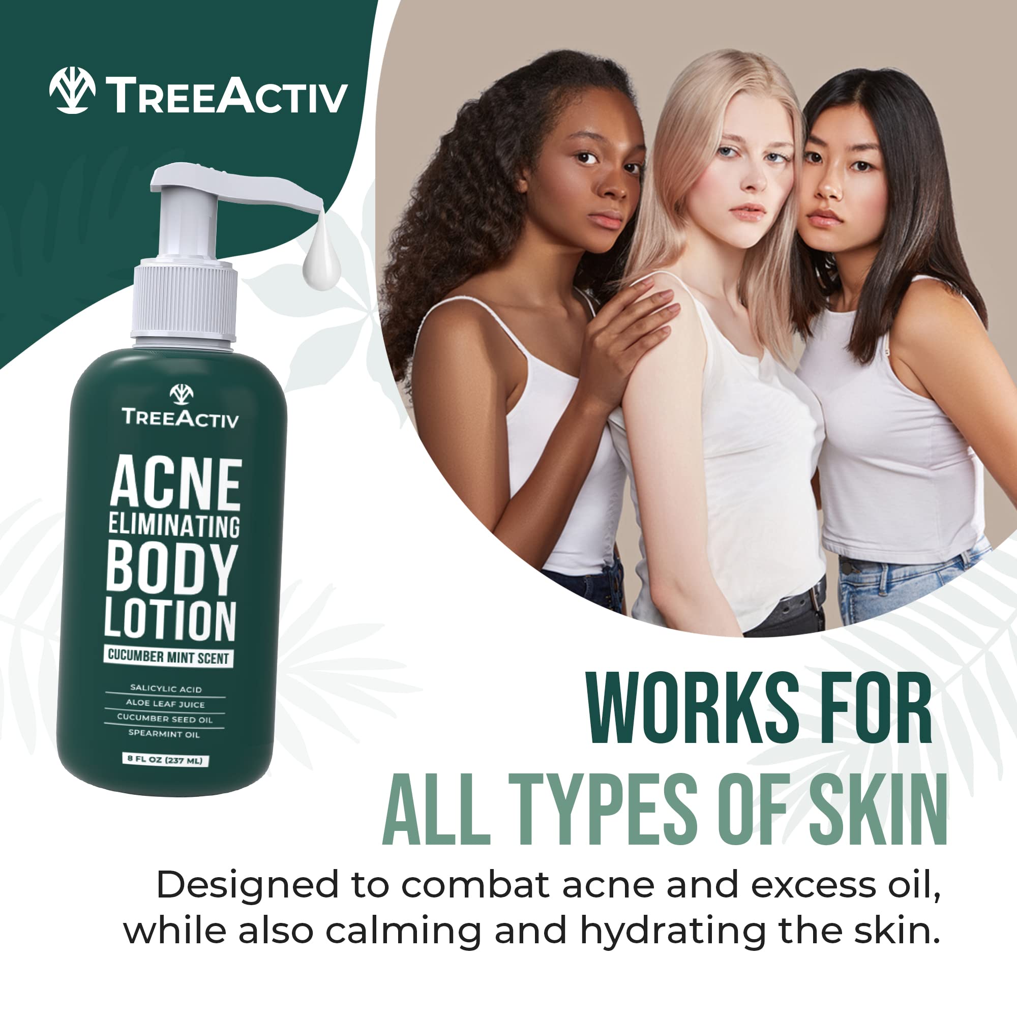 TreeActiv Acne Eliminating Body Lotion 8 fl oz | Clears Body, Back, Butt and Shoulder Acne | Anti-Acne Moisturizer | Prevents Future Breakouts | Cucumber Mint Scent
