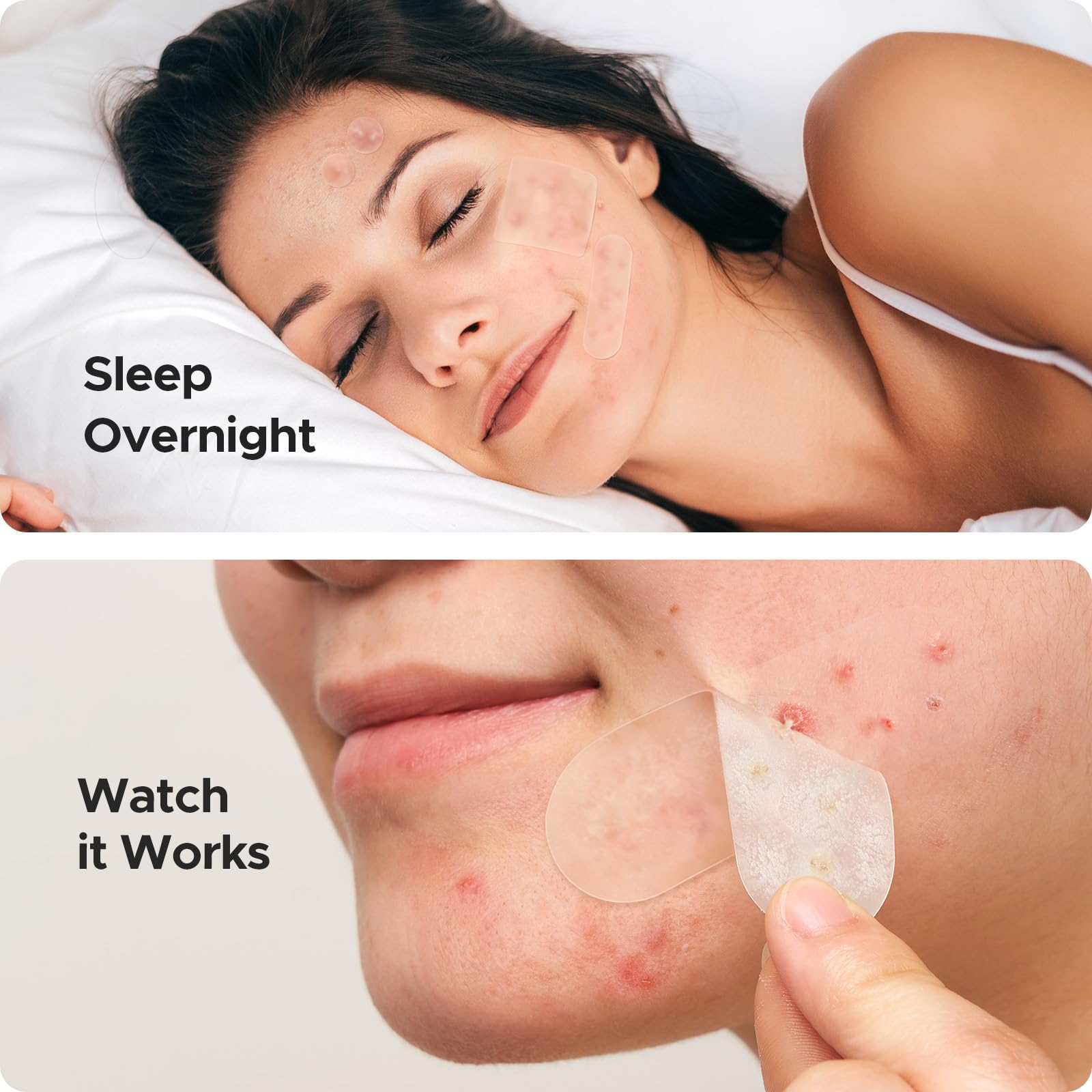 TKTK Hydrocolloid Bandages, 45 x 45 mm Large Pimple Patches for Face, XL Acne Patches for Body, Back, Forehead, Cheek Zit Breakouts, Big Hydrocolloid Patch (Square, Strip, Dot 5 Sizes 120 Count)