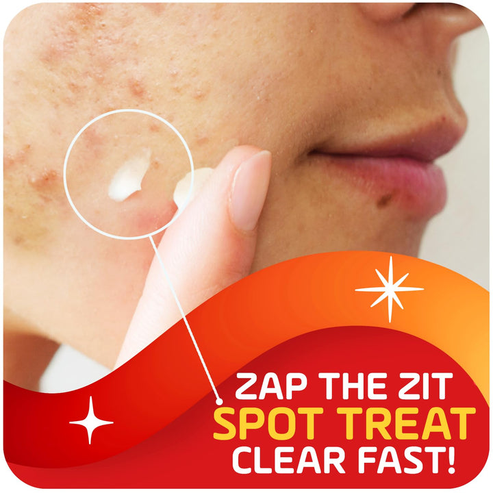 Asepxia Acne Treatment Cream for Face, 2% salicylic acid, Rapid Maximum Strength Acne Treatment, Clears Pimples and Blackheads, Prevents New Acne and Controls Excess Oil, 1 oz